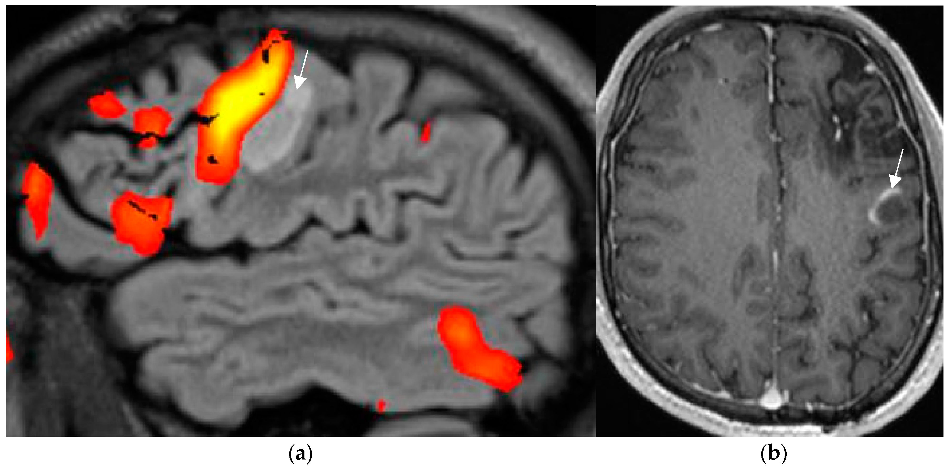 Neurolint 17 00066 g009
