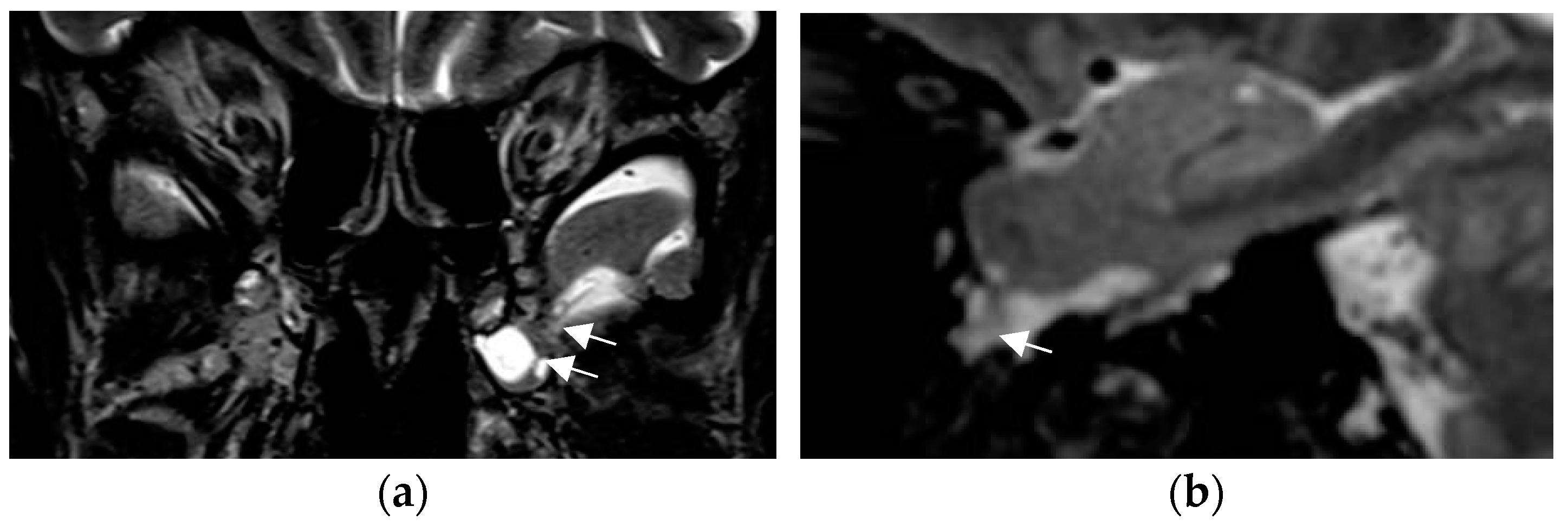 Neurolint 17 00066 g010
