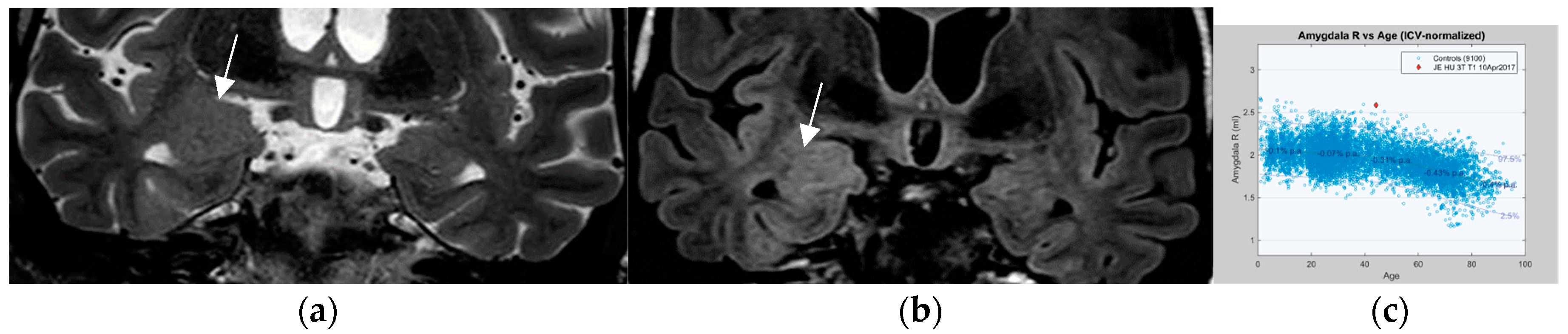 Neurolint 17 00066 g011