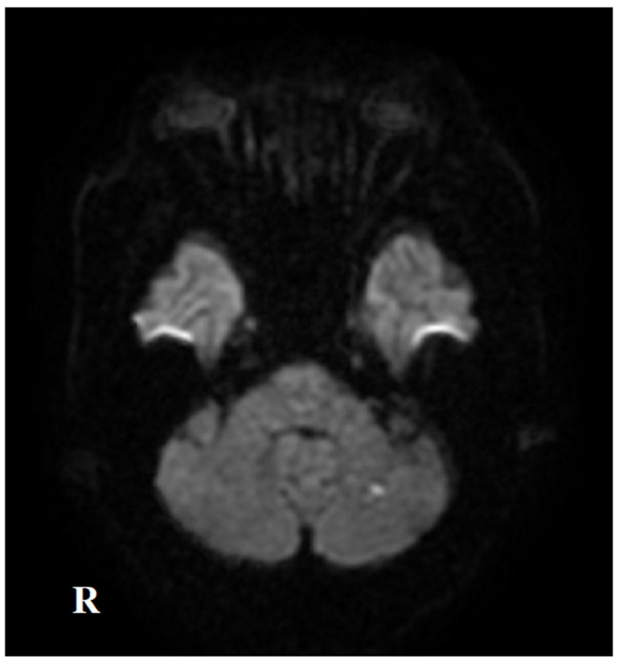 Neurolint 17 00068 g004