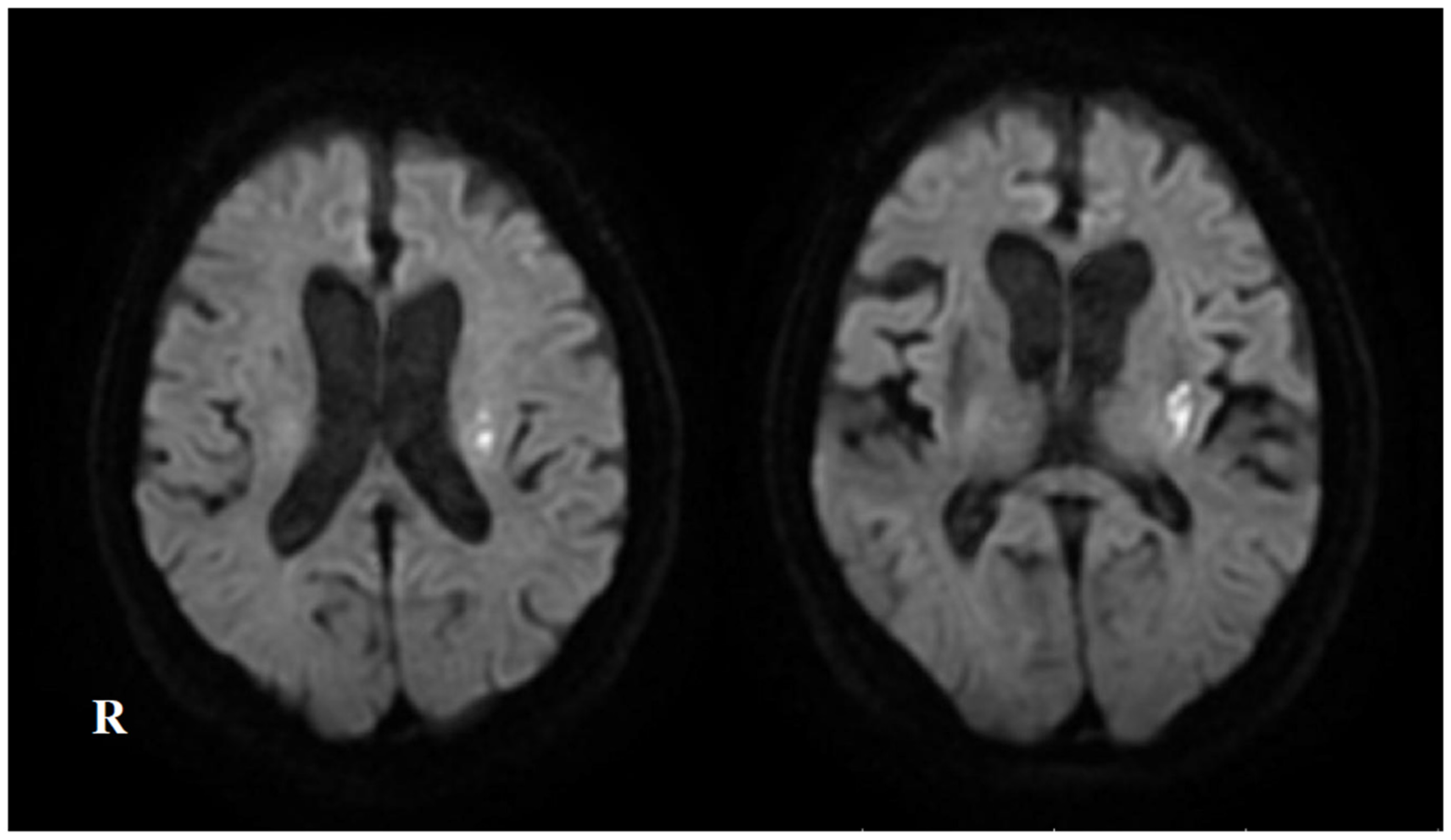 Neurolint 17 00068 g005
