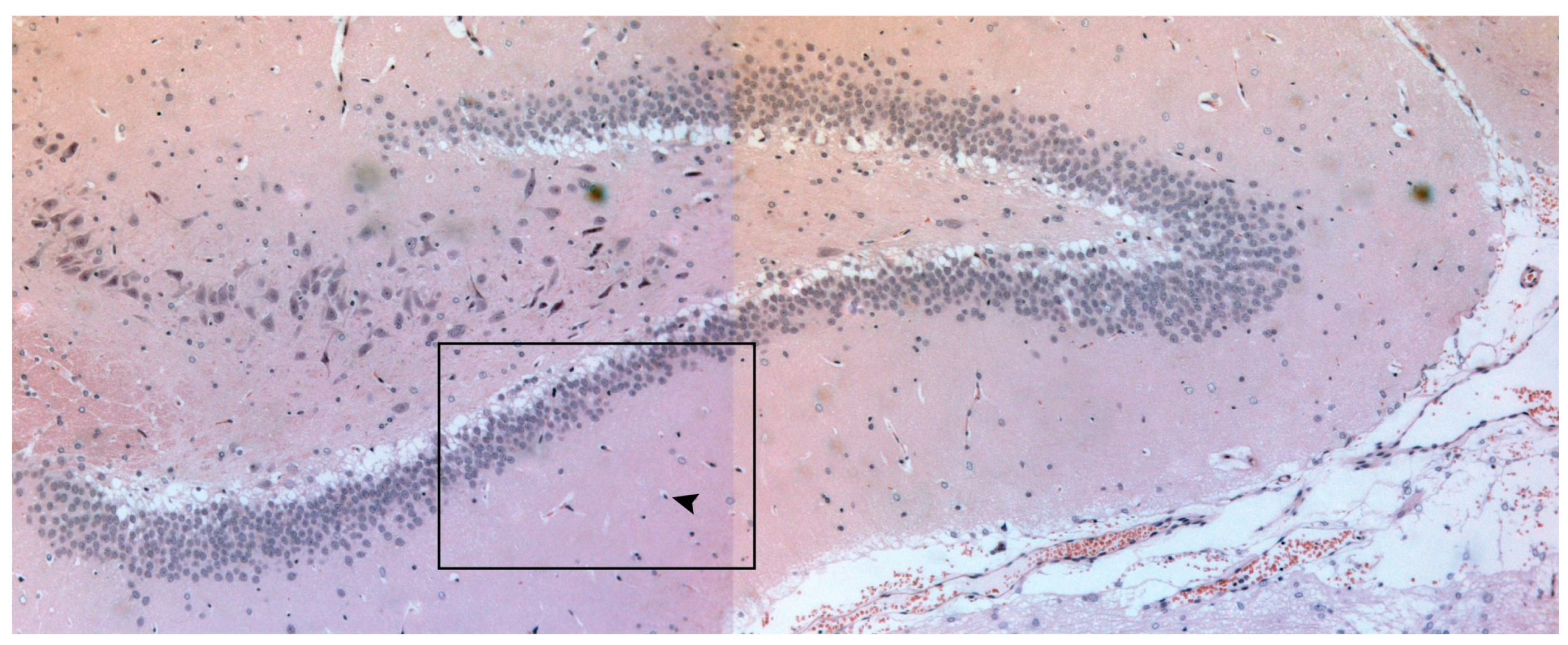 Neurolint 17 00069 g002