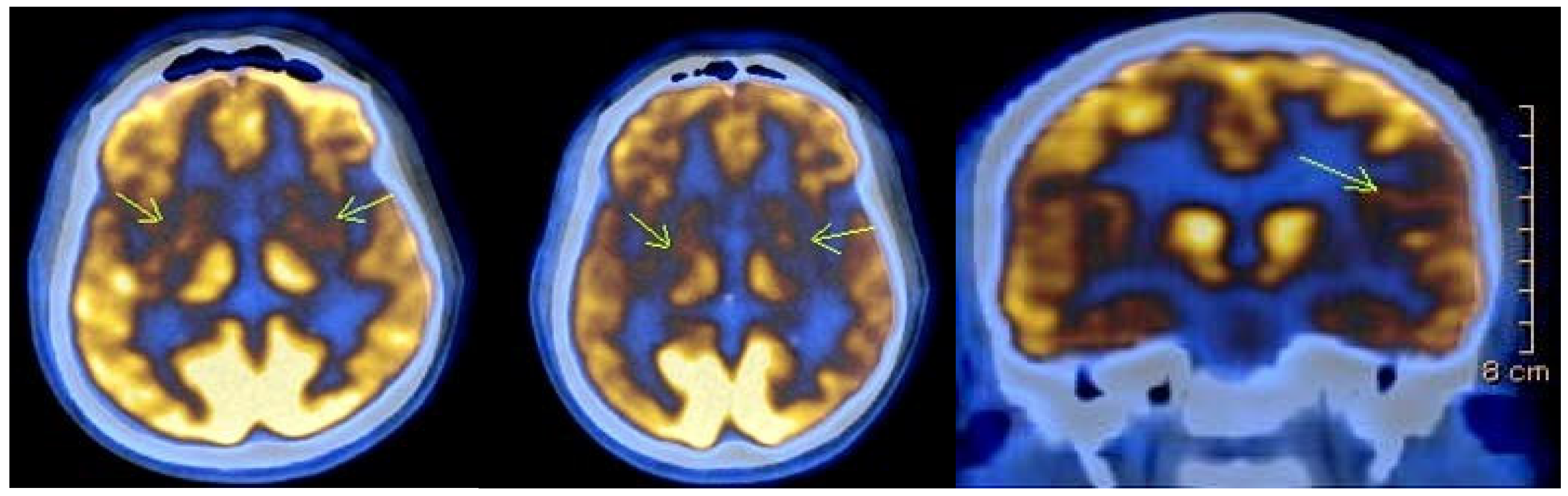 Neurolint 17 00095 g002