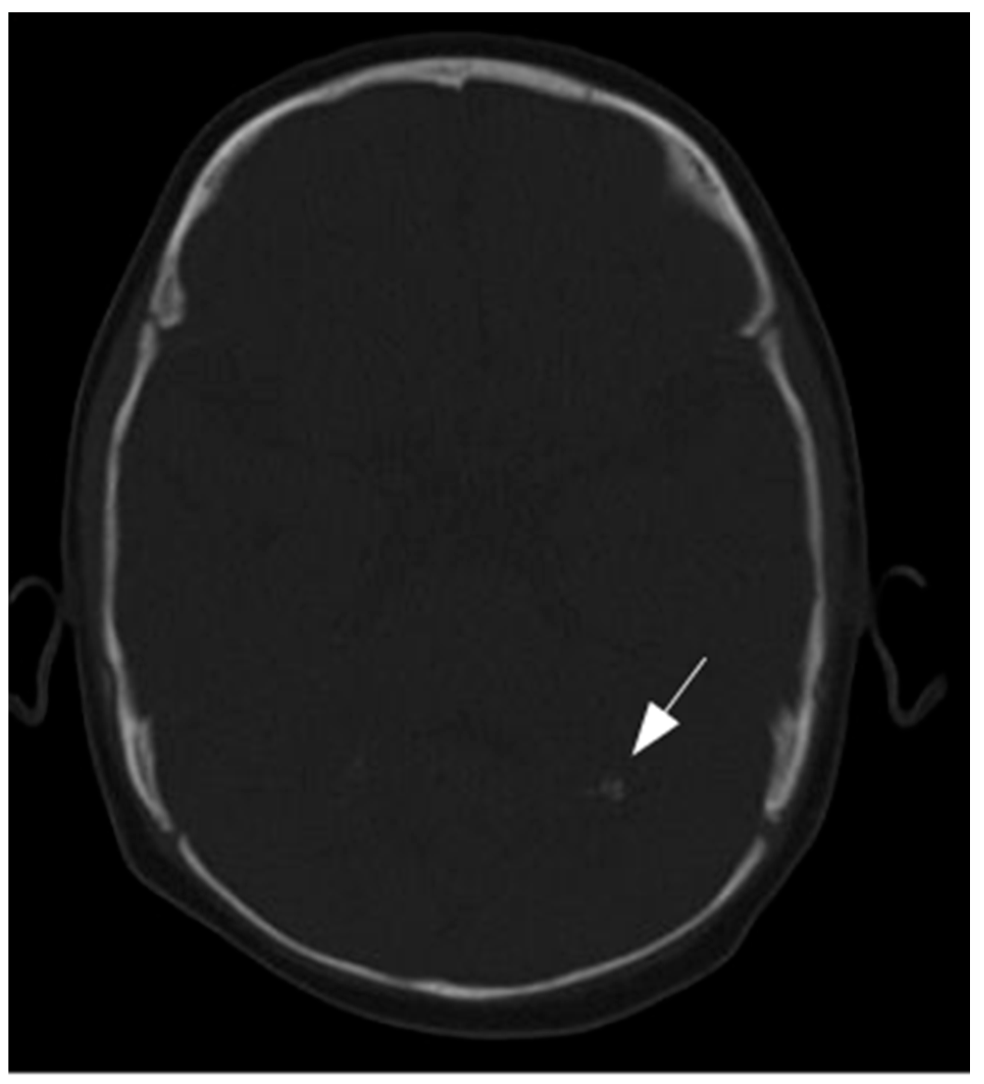 Neurolint 17 00143 g002