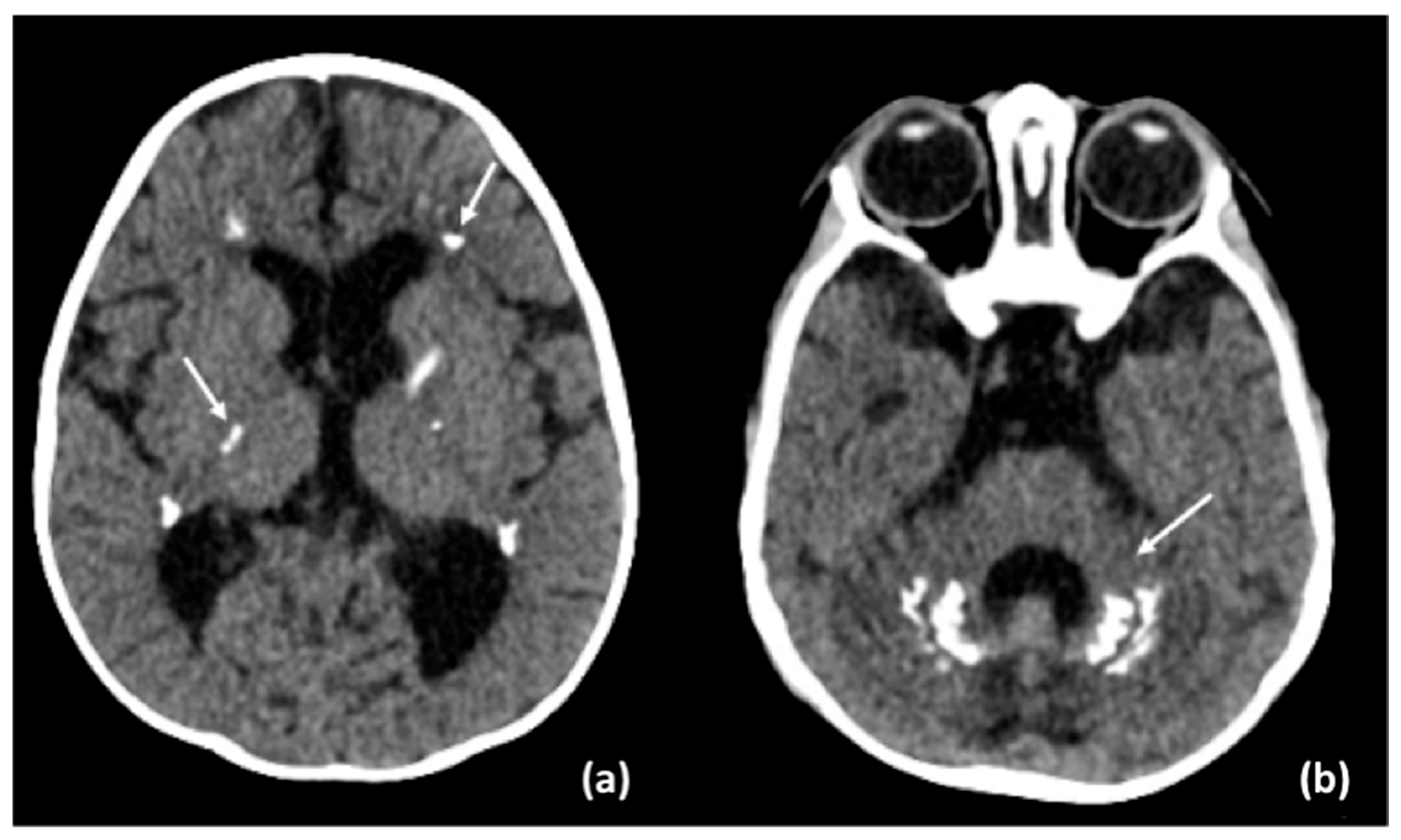 Neurolint 17 00143 g004