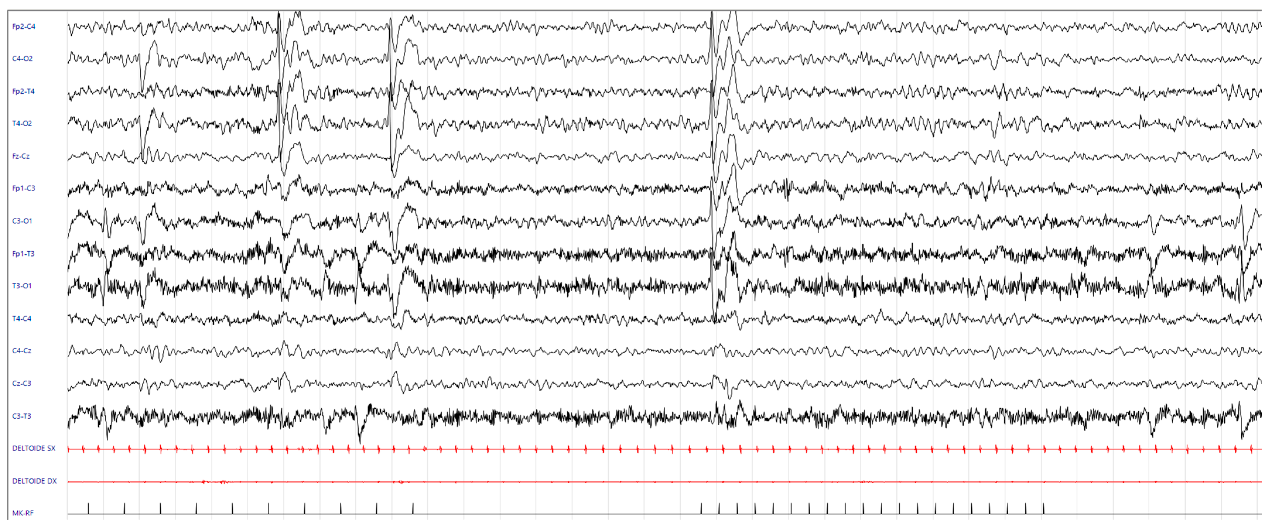 Neurolint 17 00143 g005