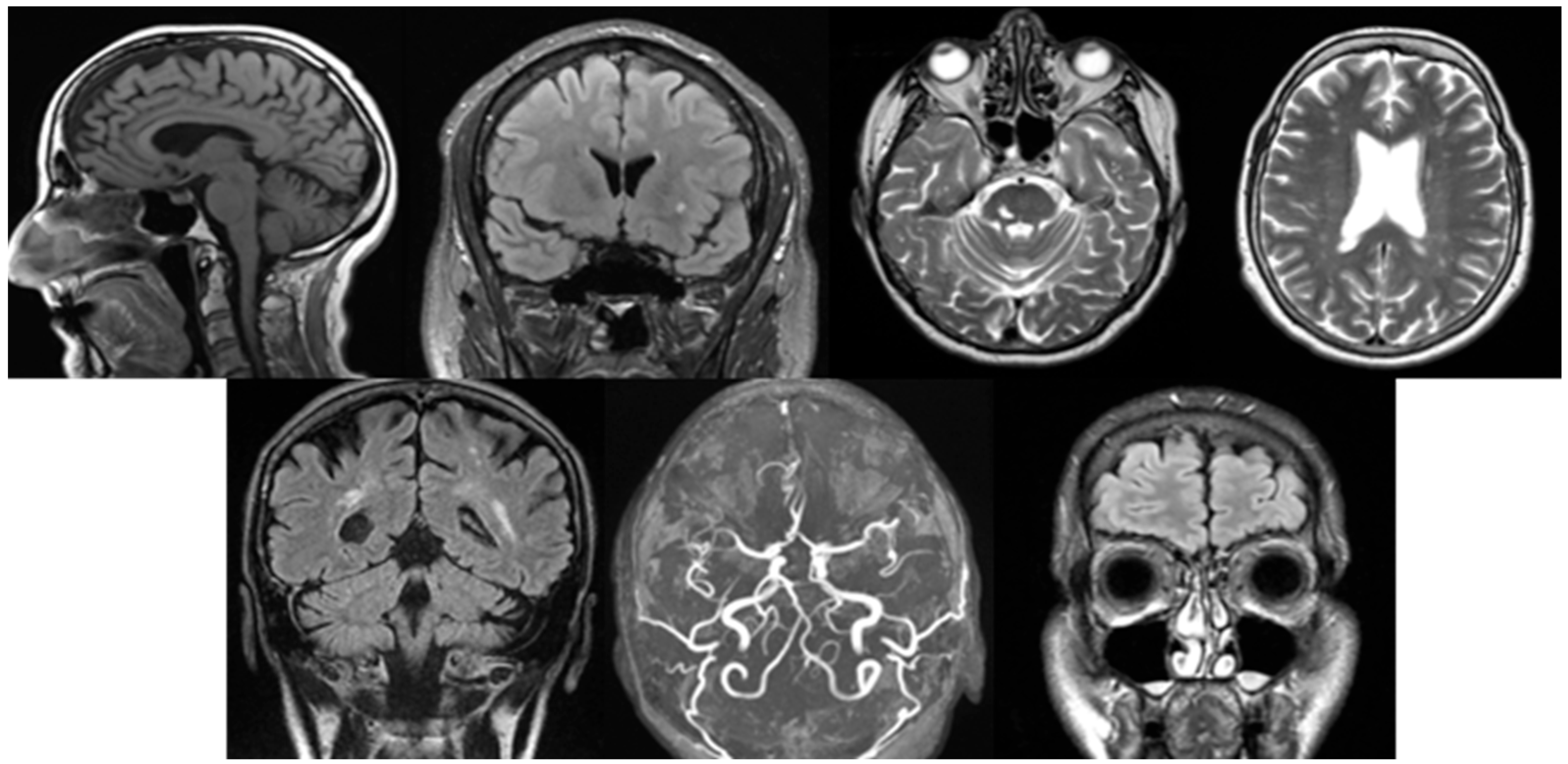 Neurolint 17 00146 g001