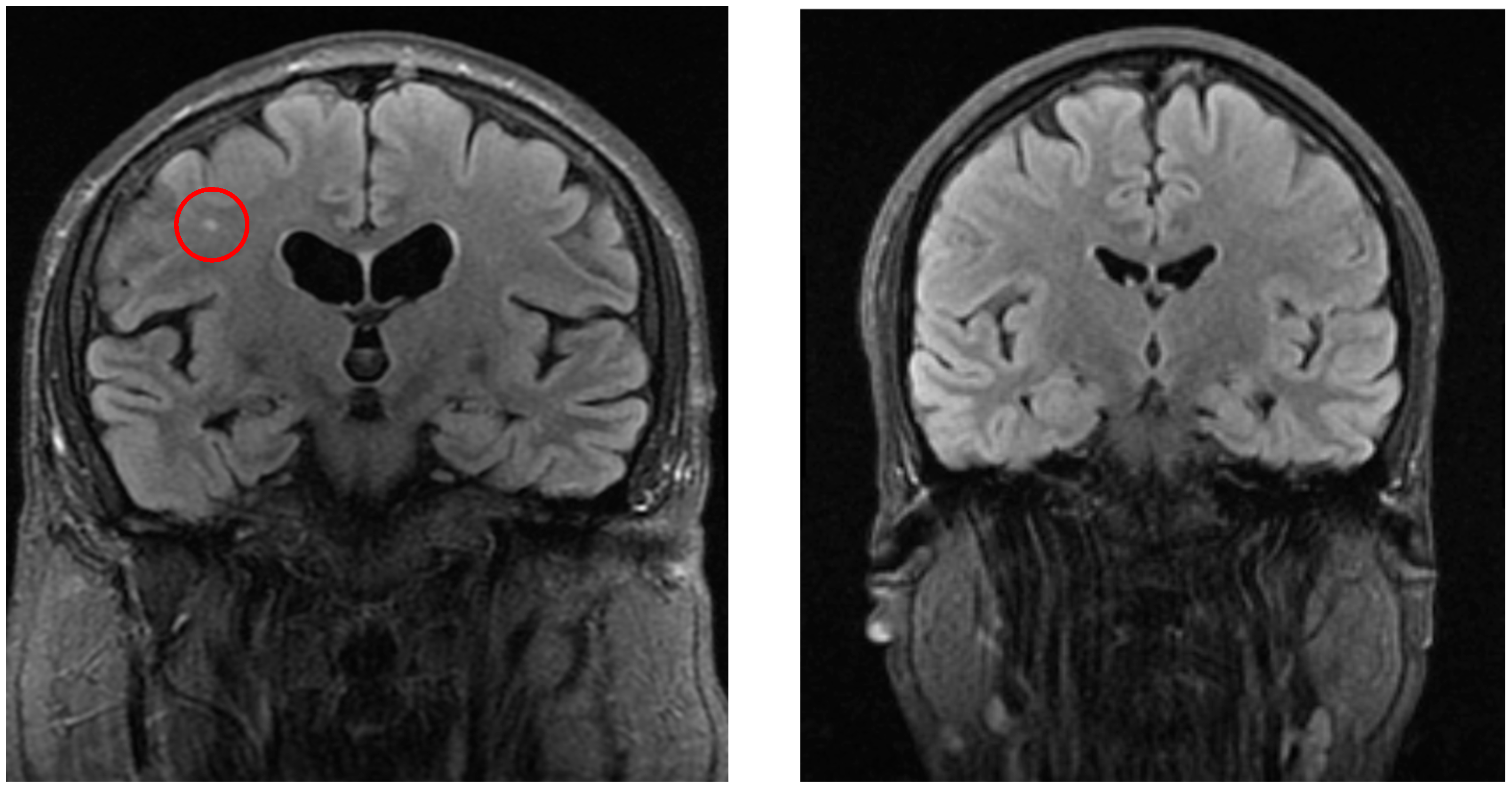Neurolint 17 00146 g002