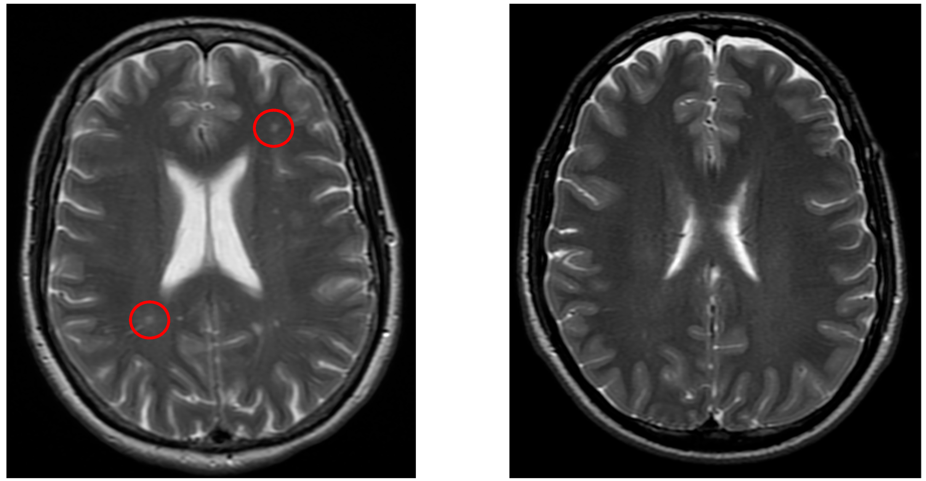 Neurolint 17 00146 g003