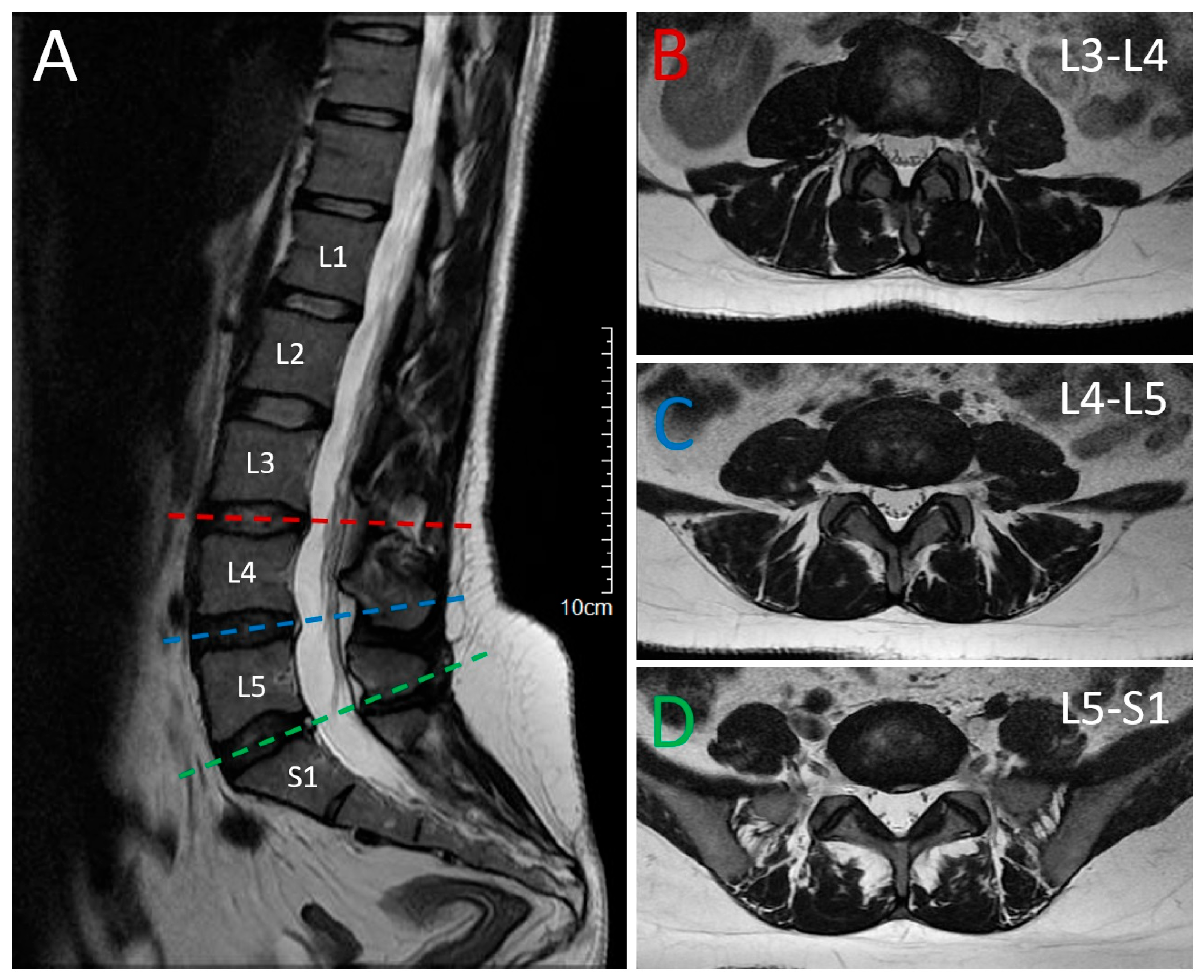 Neurolint 17 00167 g001 Neurolint 17 00167 g001