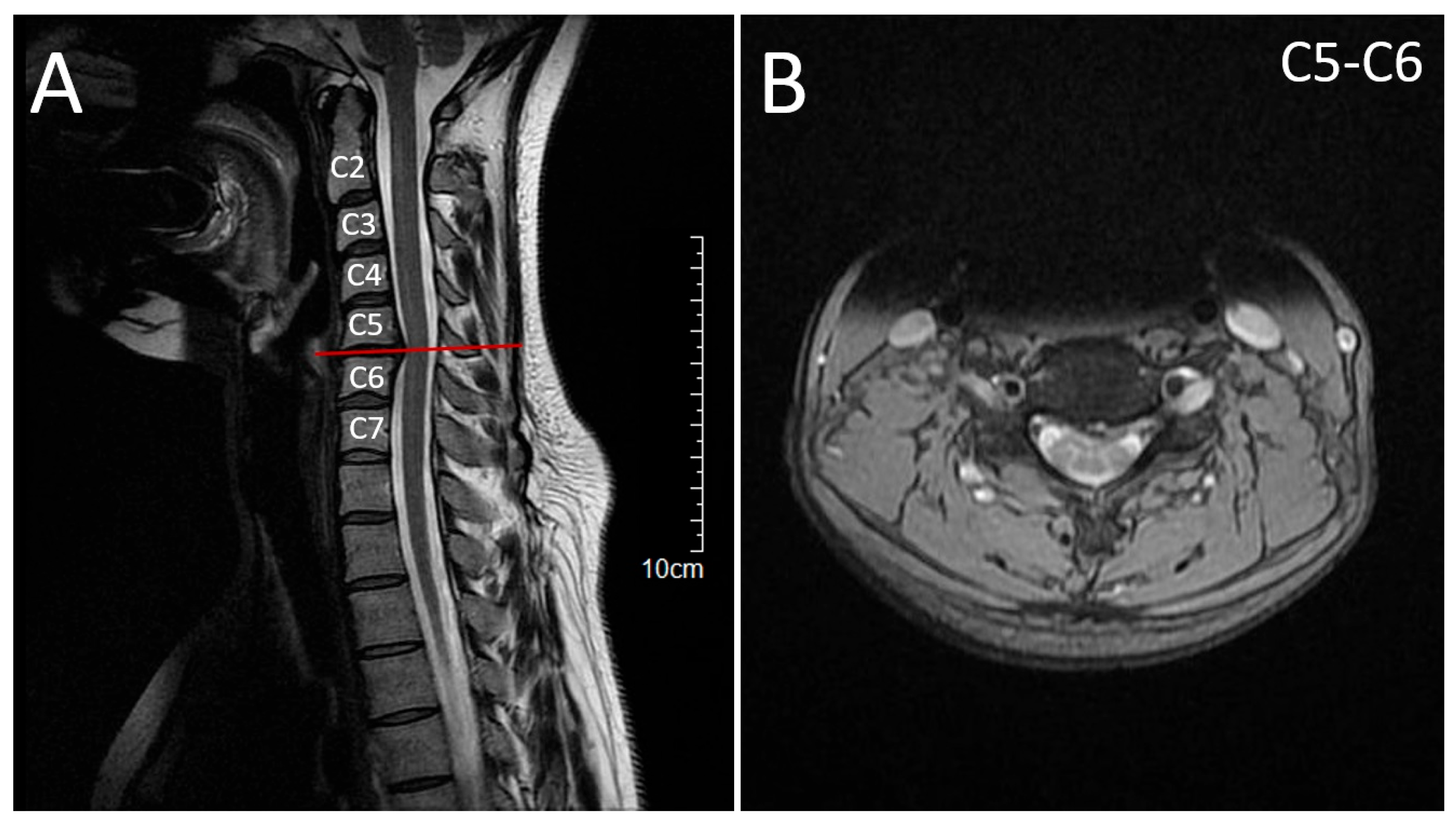 Neurolint 17 00167 g003 Neurolint 17 00167 g003