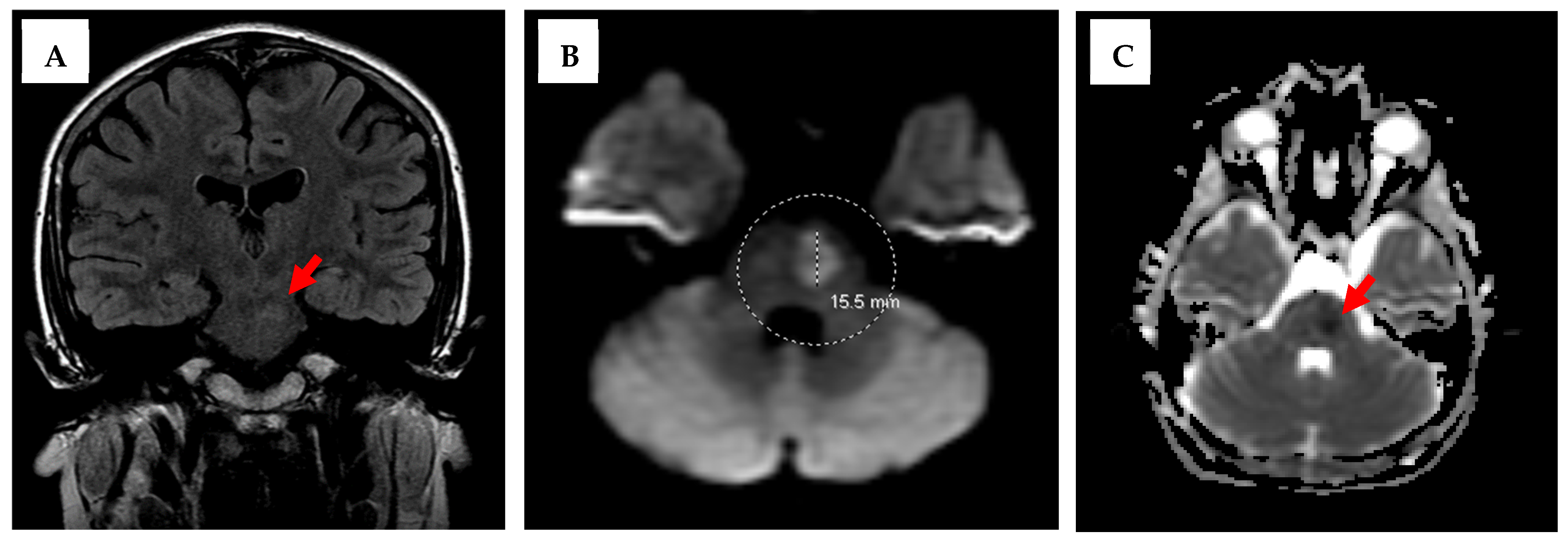 Neurolint 17 00178 g002 Neurolint 17 00178 g002