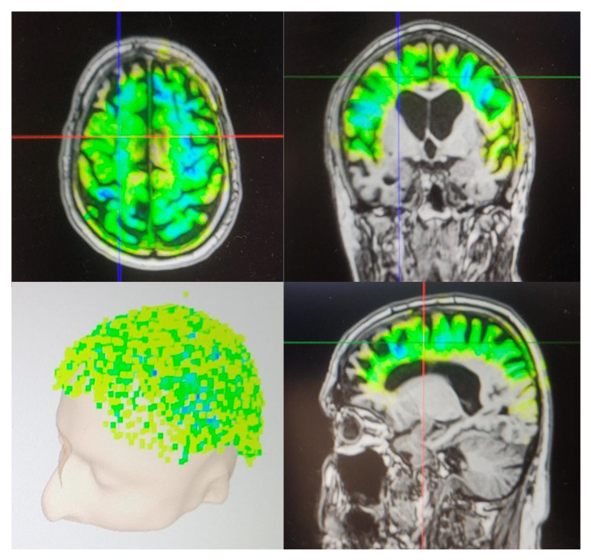 Neurolint 17 00188 g001 Neurolint 17 00188 g001