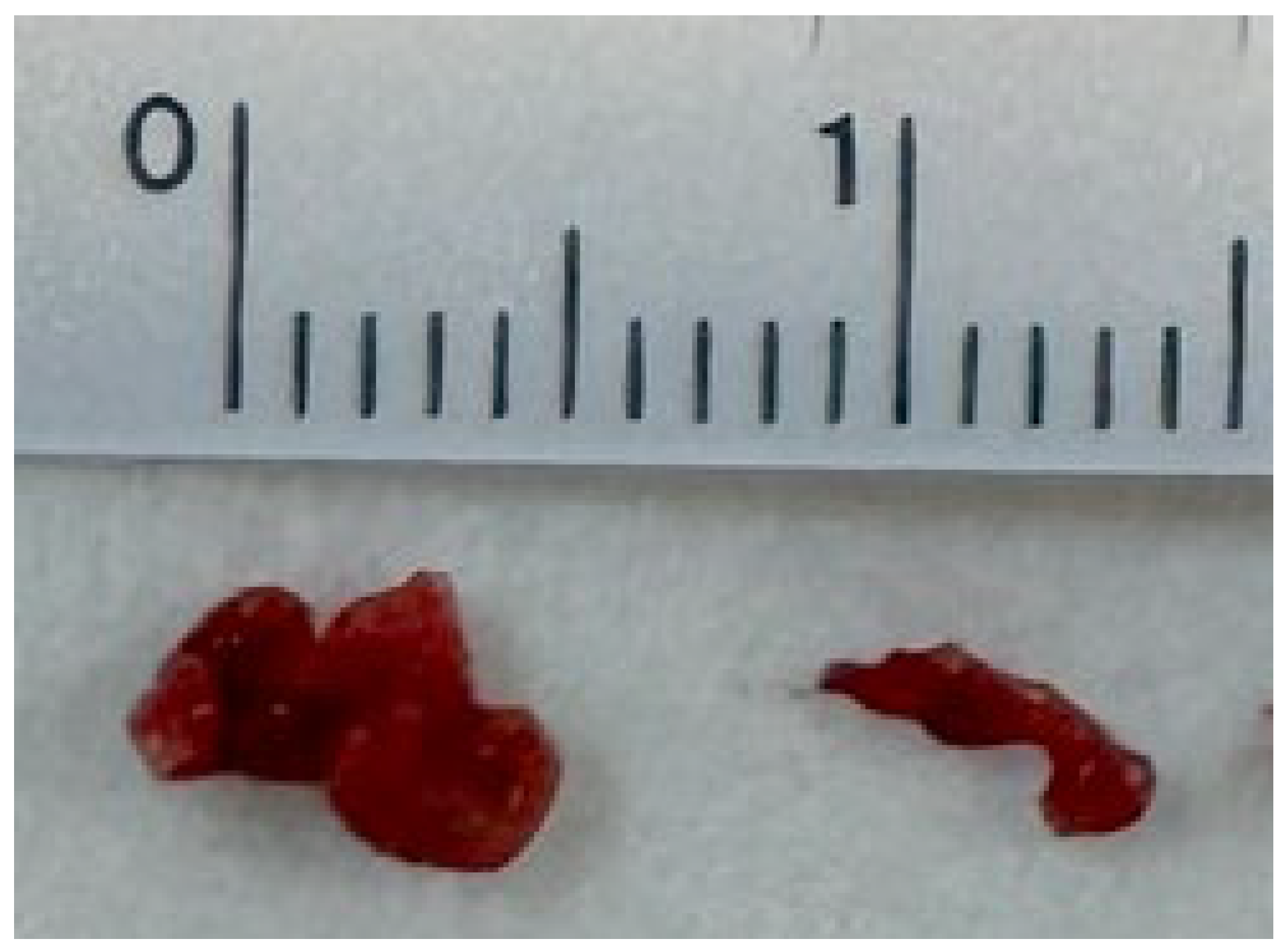 Neurolint 17 00190 g004