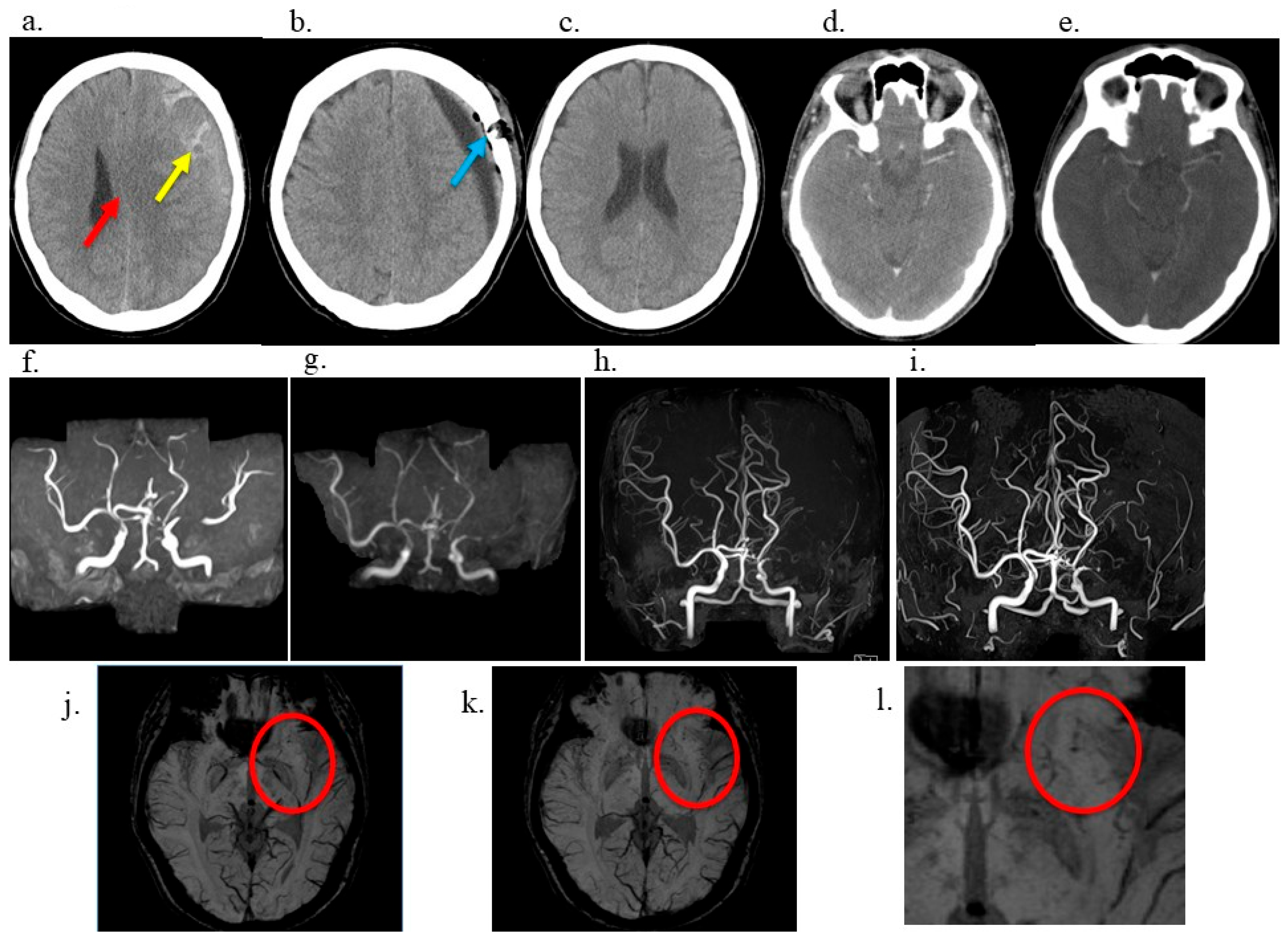 Neurolint 17 00191 g001