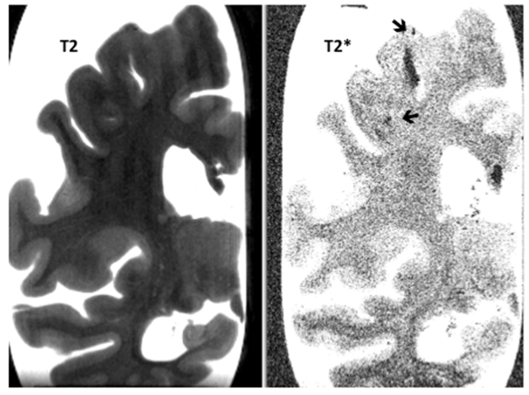 Neurosci 01 00011 g002