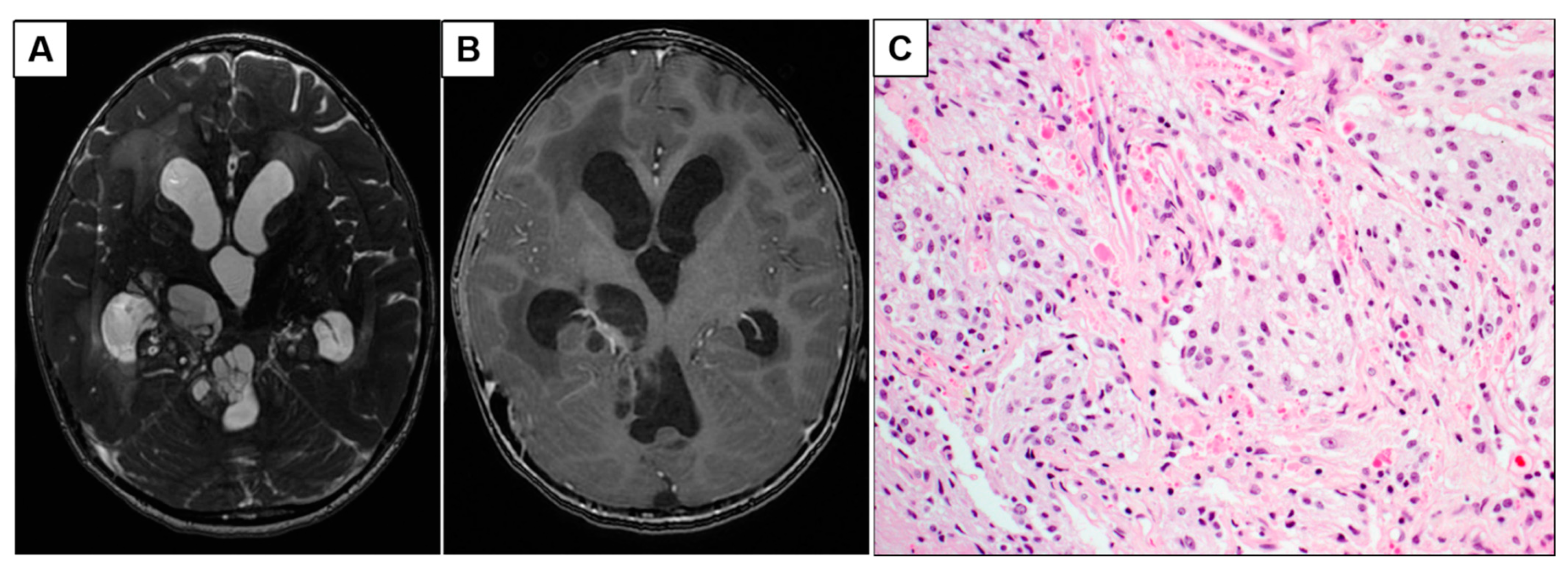 Neurosci 02 00006 g002 Neurosci 02 00006 g002