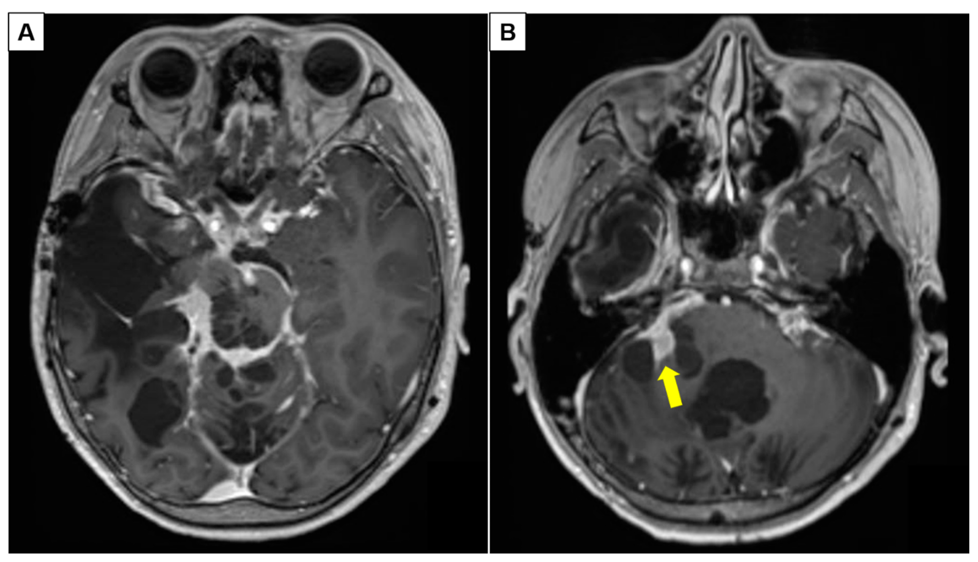 Neurosci 02 00006 g003 Neurosci 02 00006 g003
