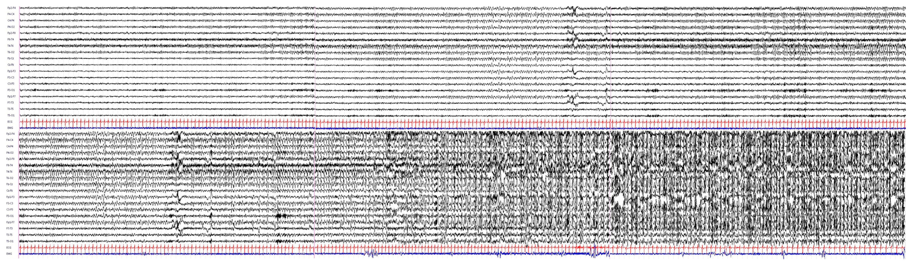 Neurosci 02 00031 g001