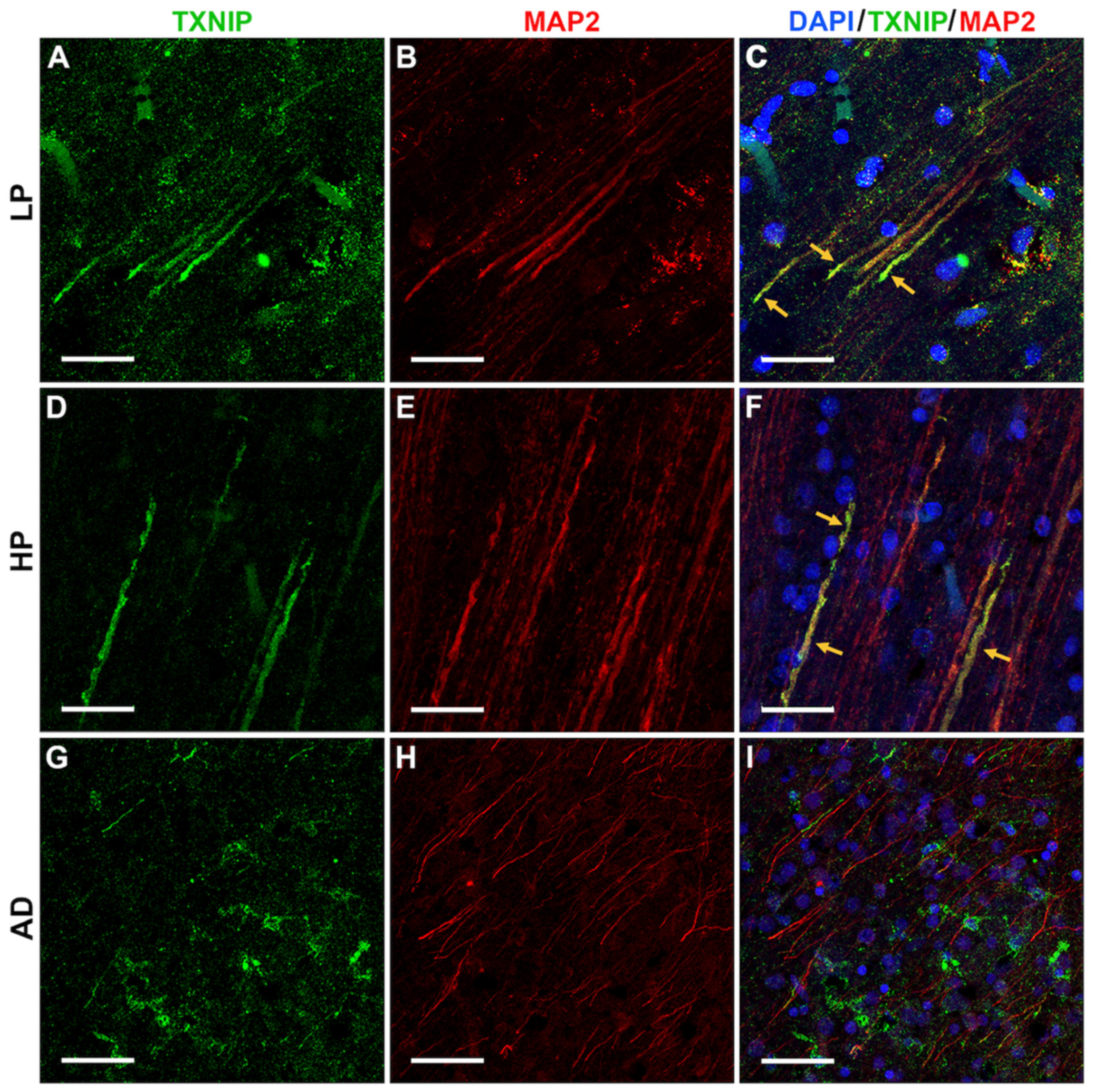 Neurosci 03 00013 g006 Neurosci 03 00013 g006