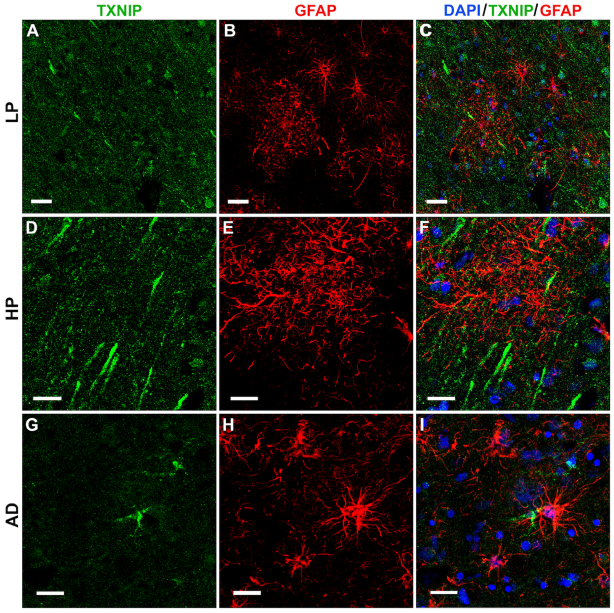 Neurosci 03 00013 g008 Neurosci 03 00013 g008