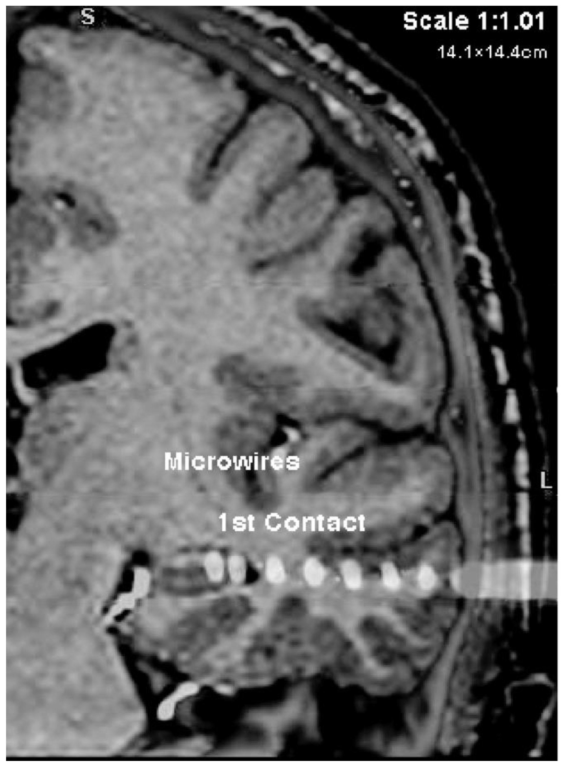 Neurosci 03 00031 g0a3