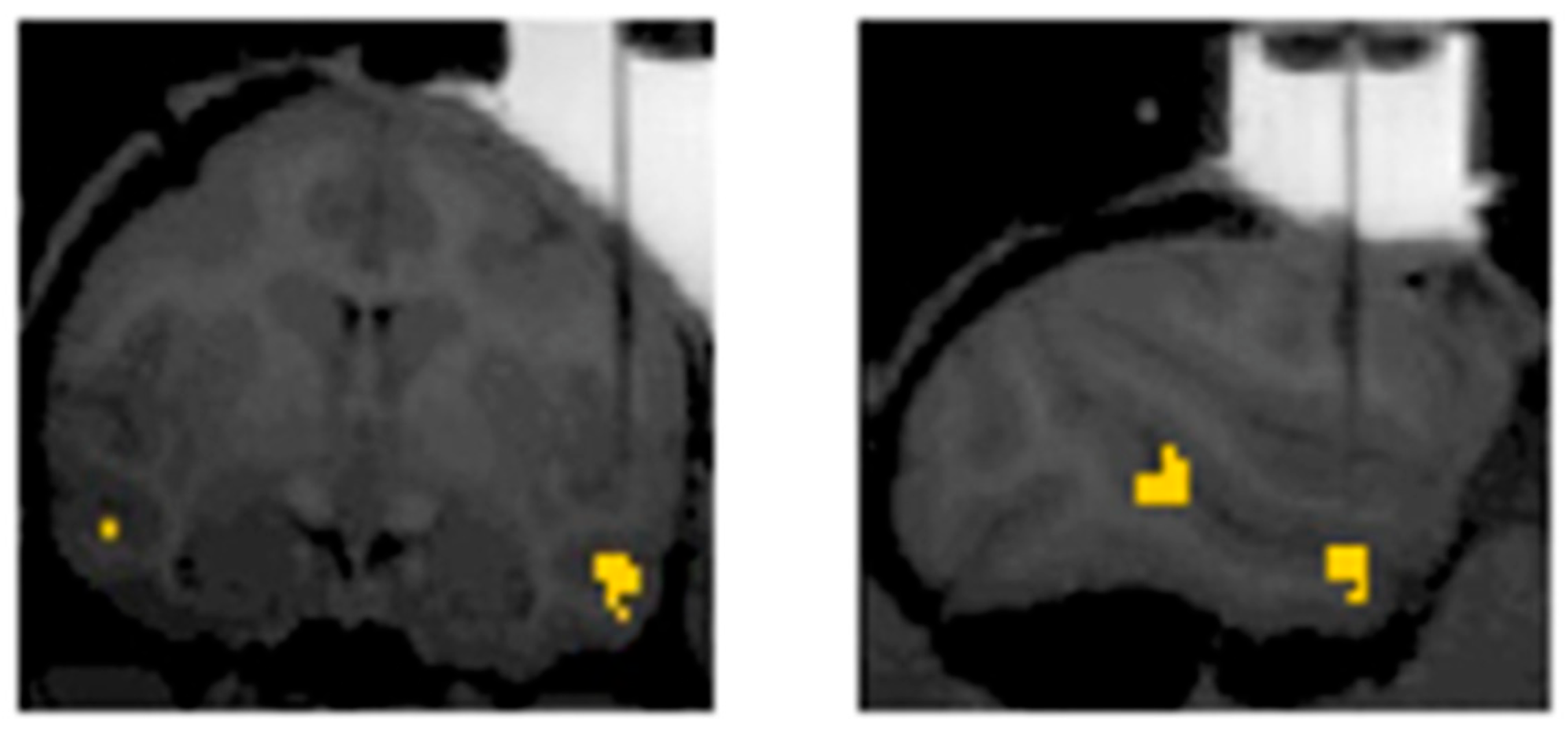 Neurosci 03 00037 g009