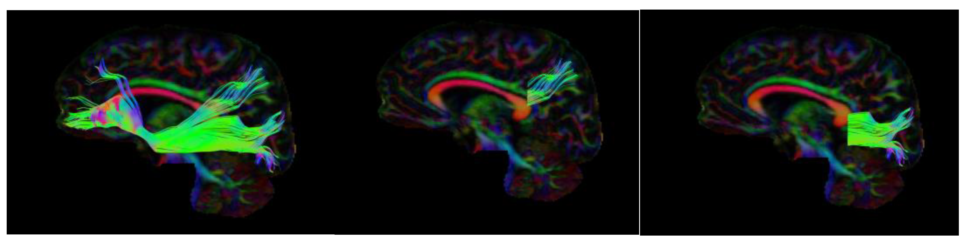 Neurosci 05 00003 g001