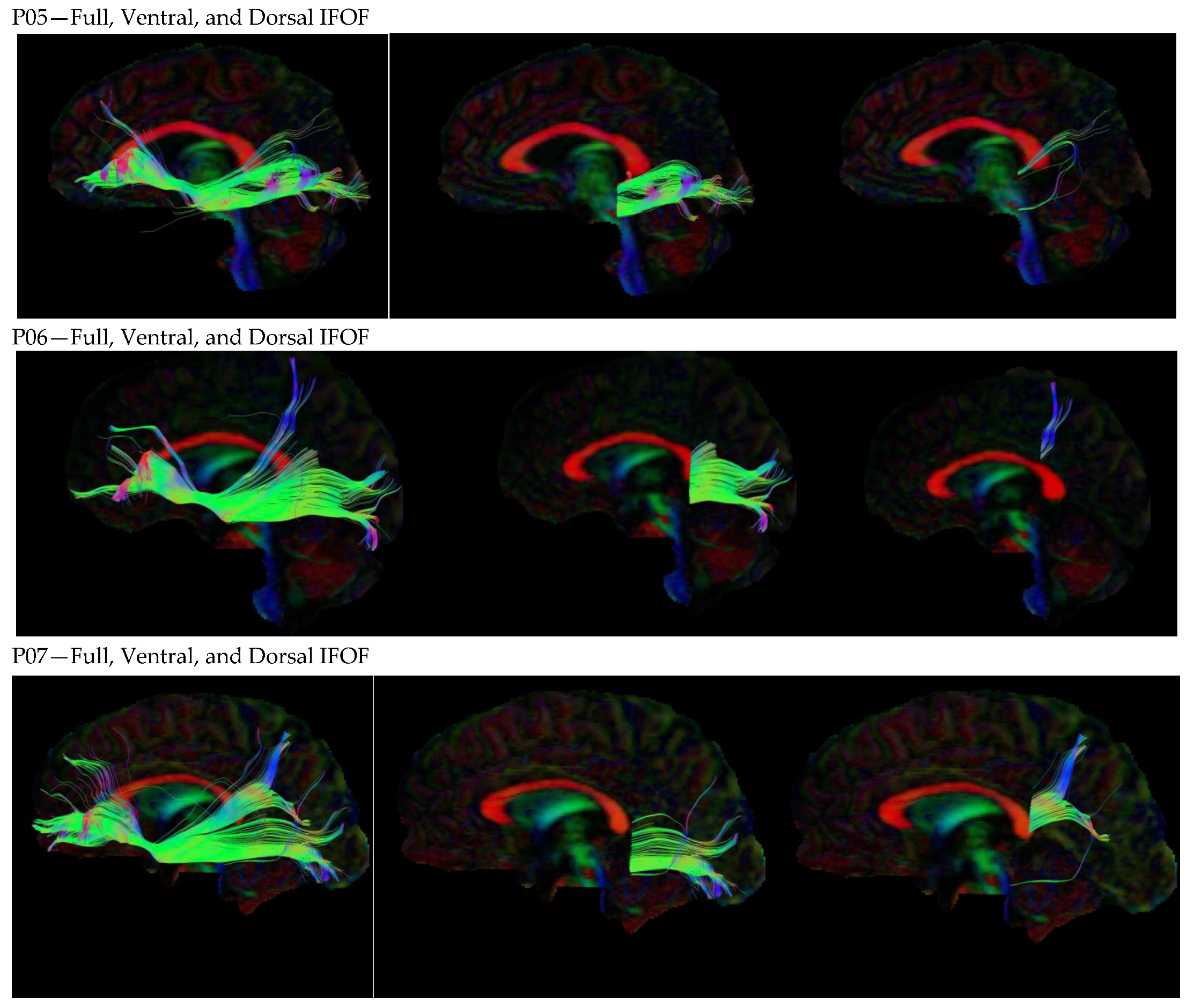 Neurosci 05 00003 g0a1a