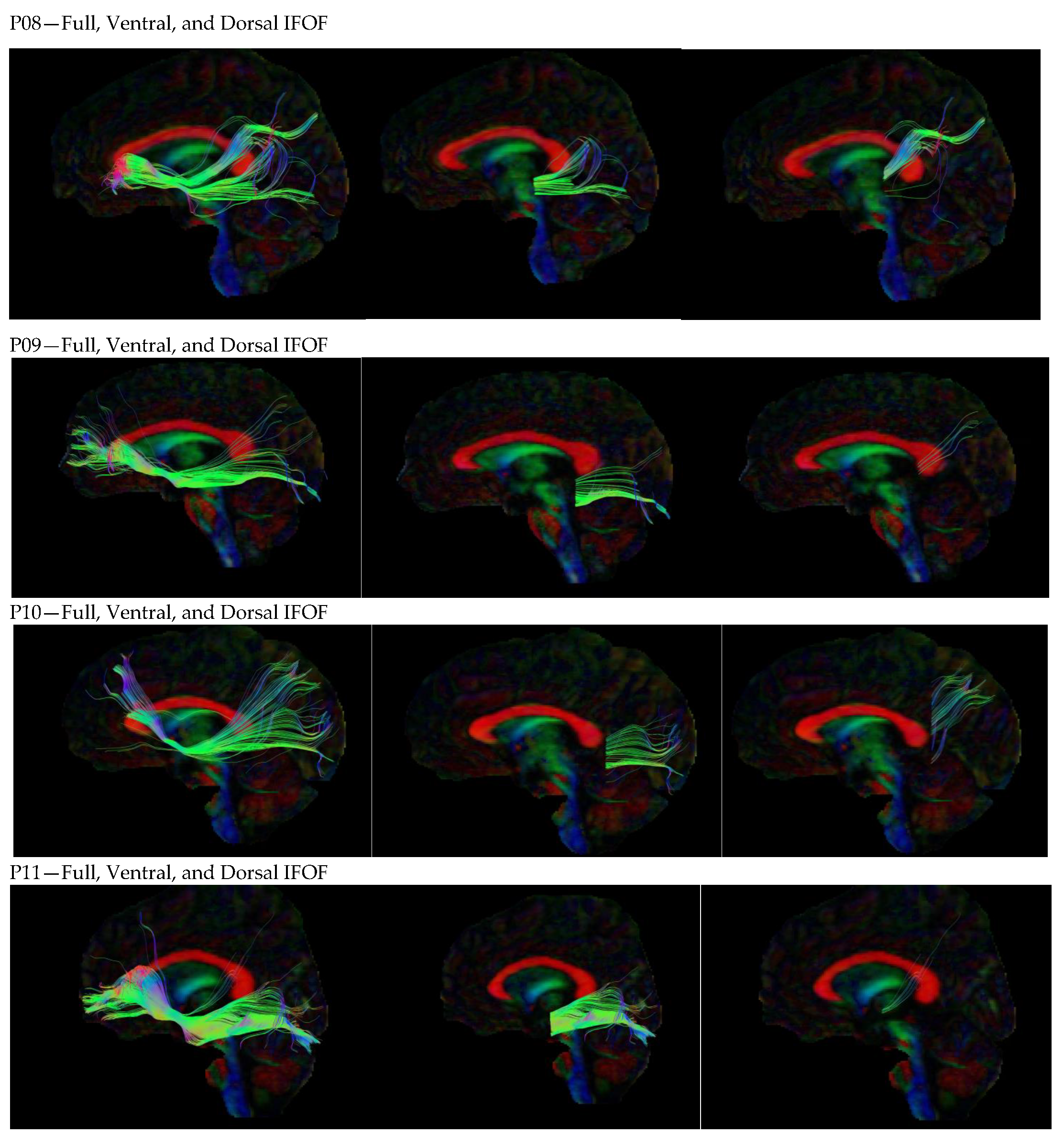 Neurosci 05 00003 g0a1b