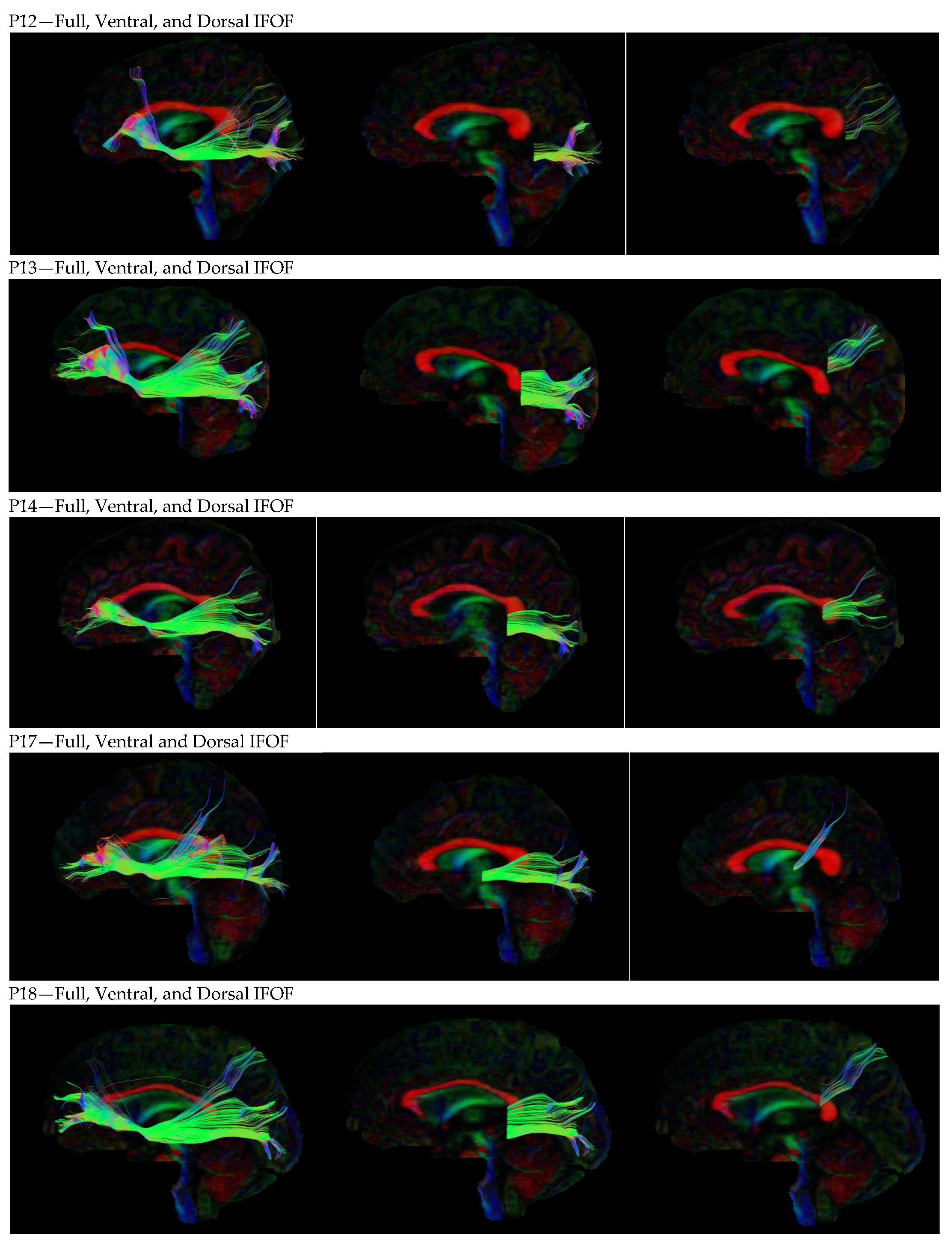Neurosci 05 00003 g0a1c