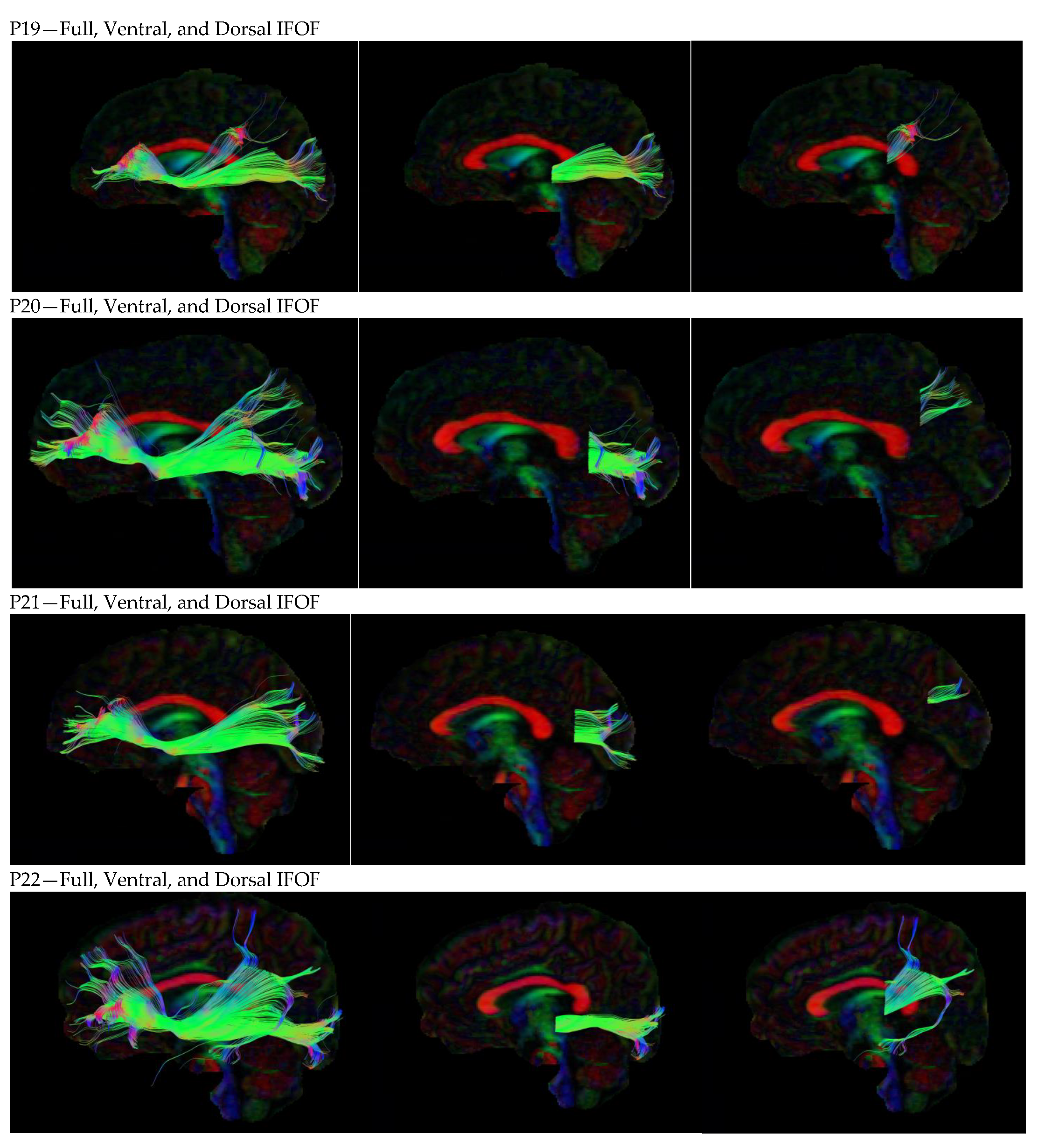 Neurosci 05 00003 g0a1d