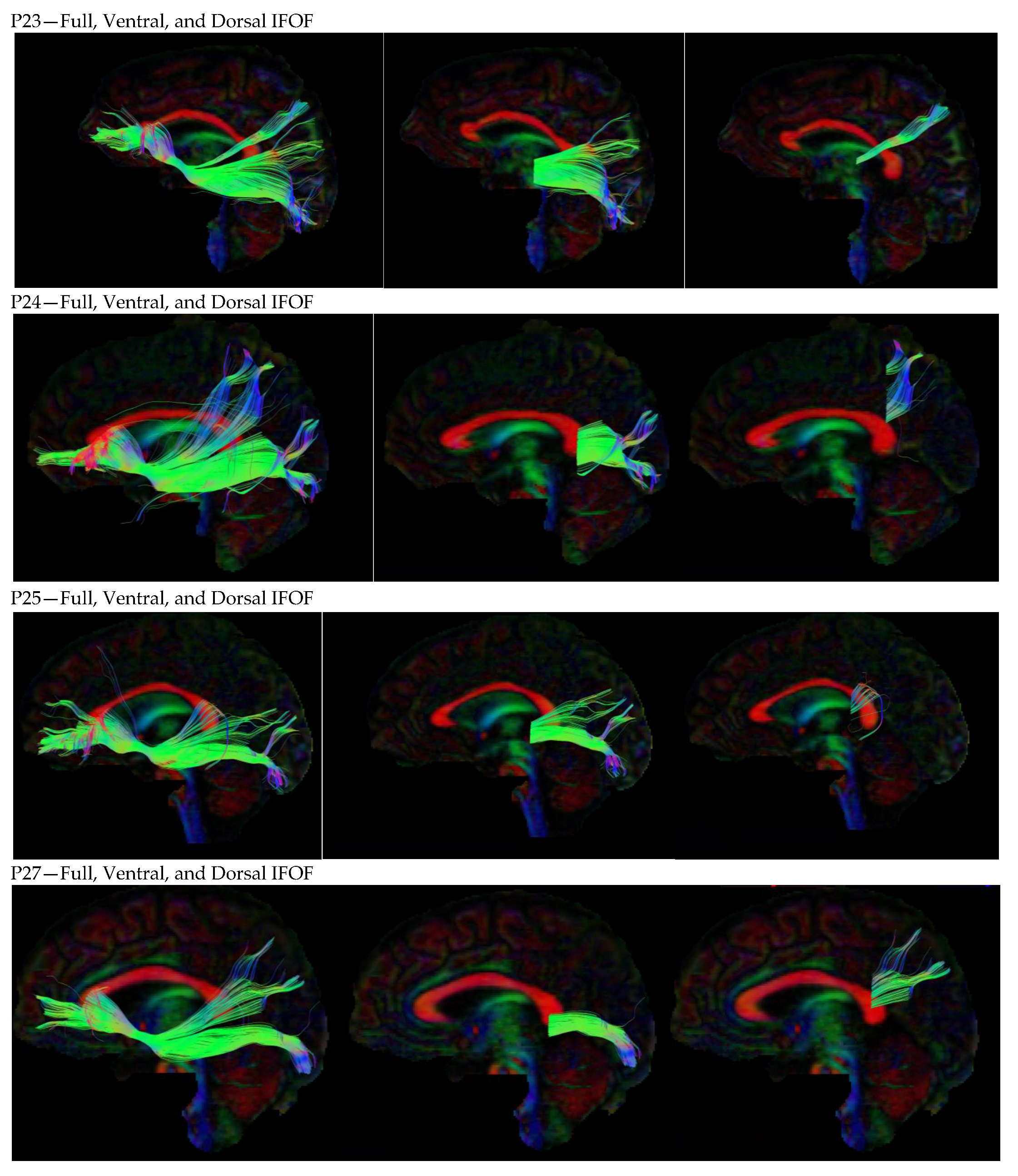 Neurosci 05 00003 g0a1e
