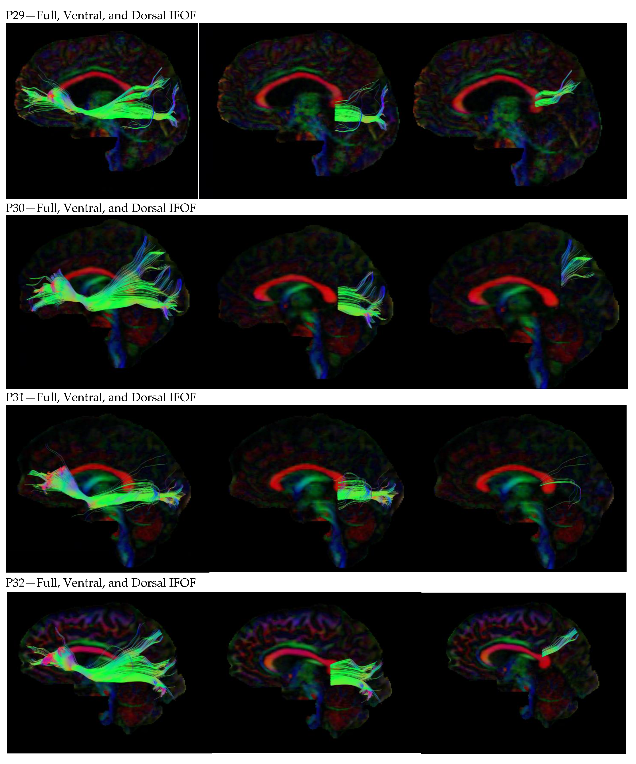 Neurosci 05 00003 g0a1f