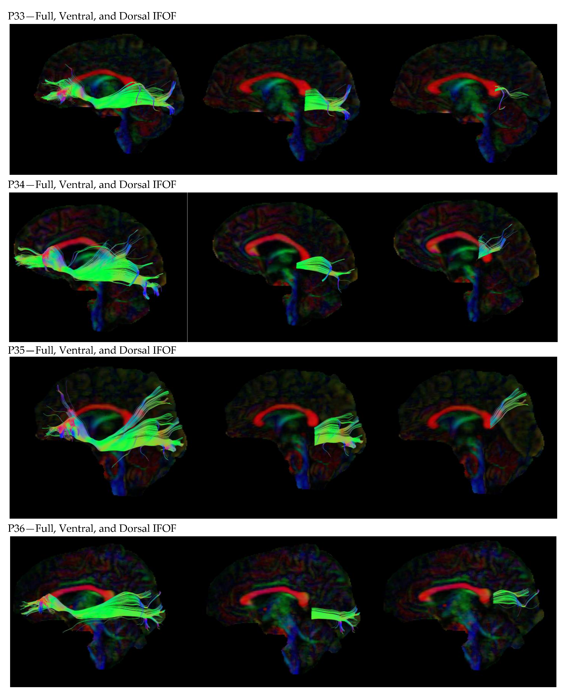 Neurosci 05 00003 g0a1g