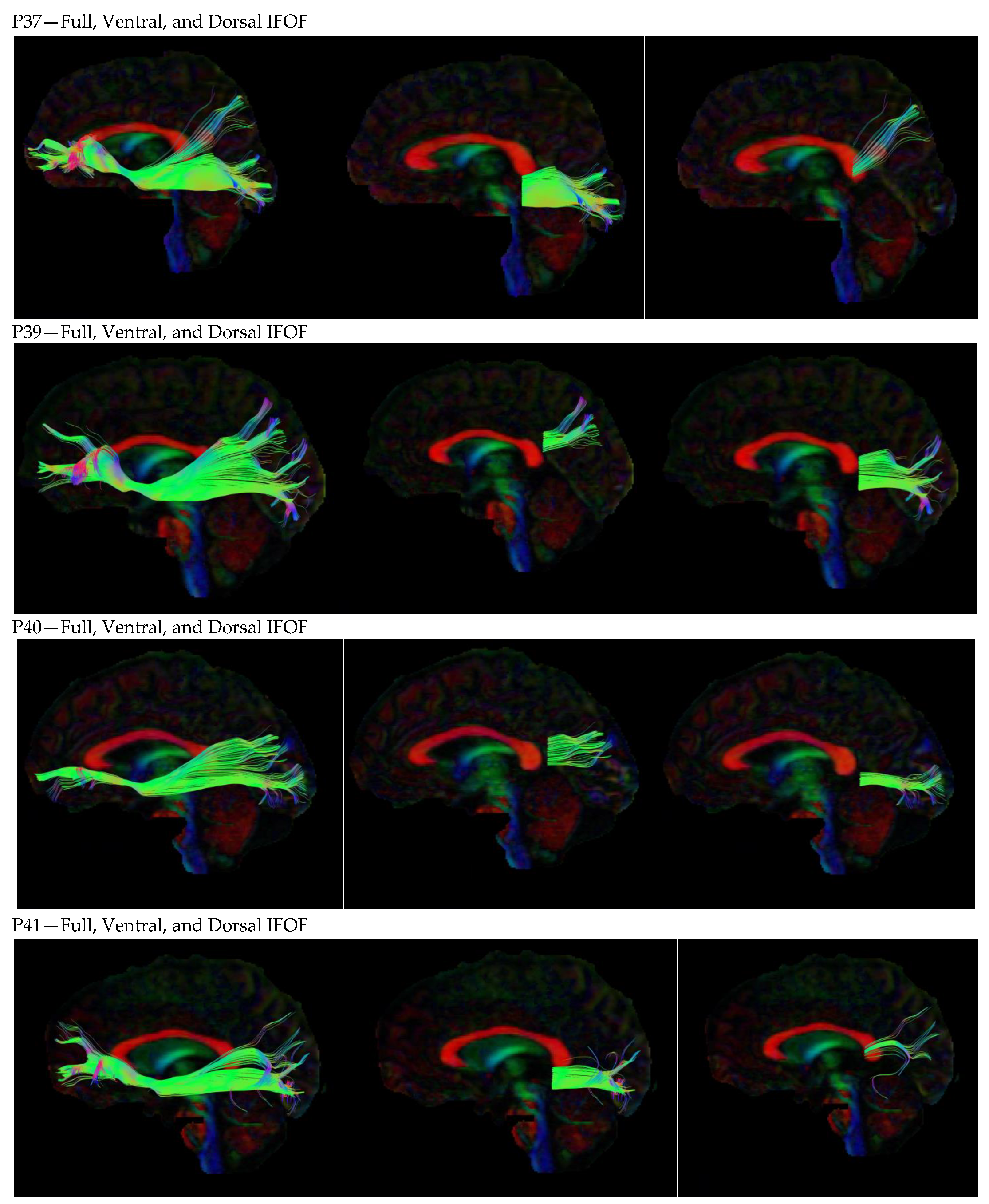 Neurosci 05 00003 g0a1h