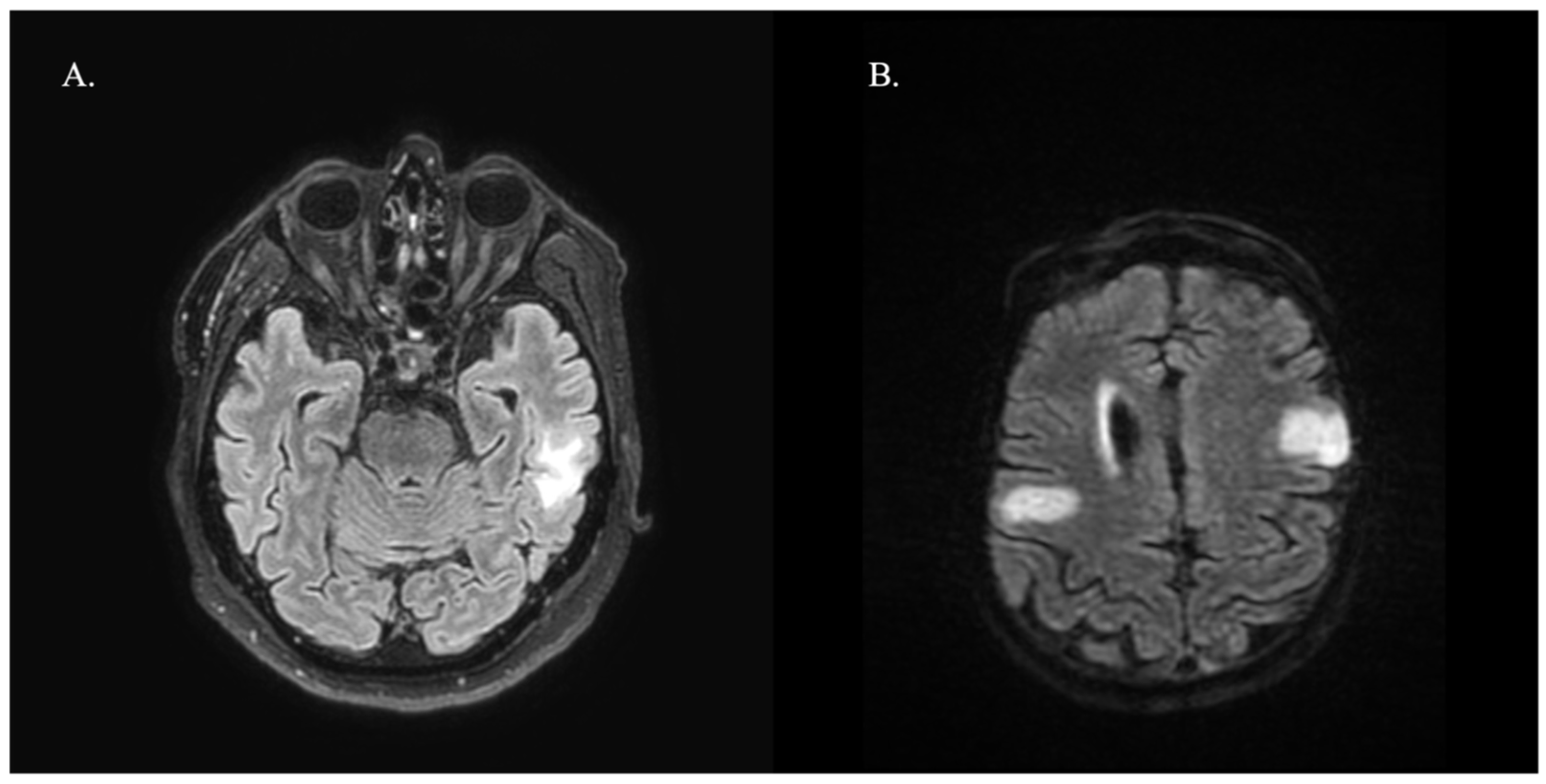 Neurosci 05 00015 g001
