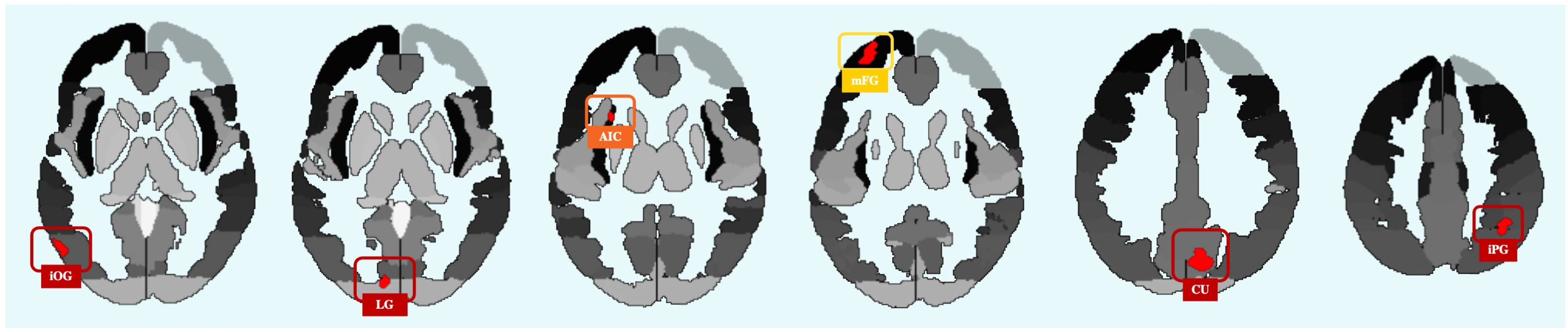 Neurosci 05 00040 g003 Neurosci 05 00040 g003