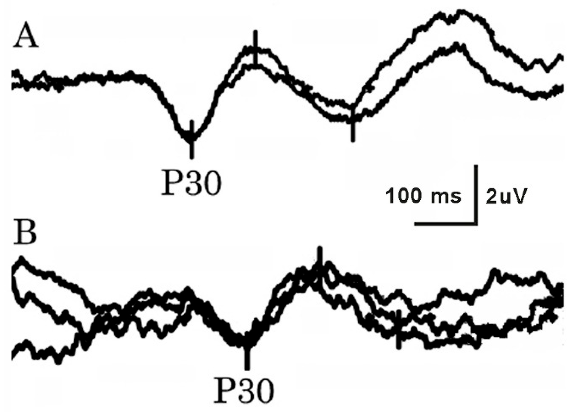 Neurosci 06 00058 g002