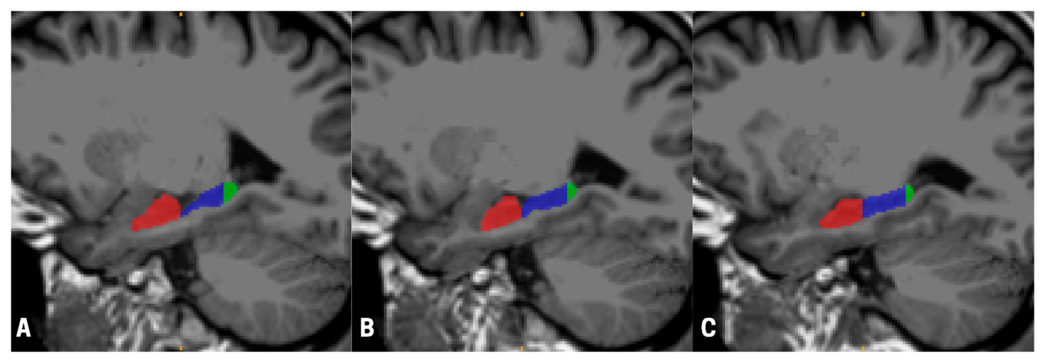 Neurosci 06 00070 g001