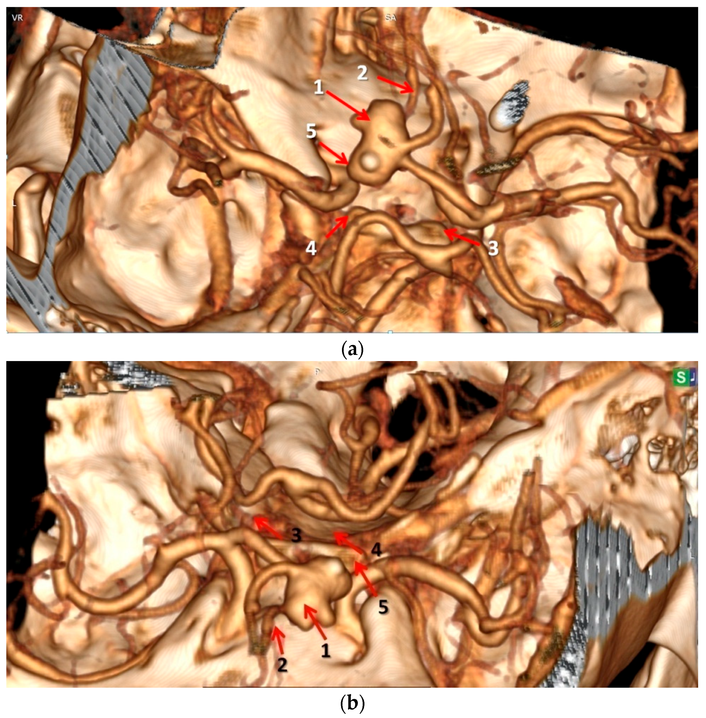 Neurosci 06 00081 g003