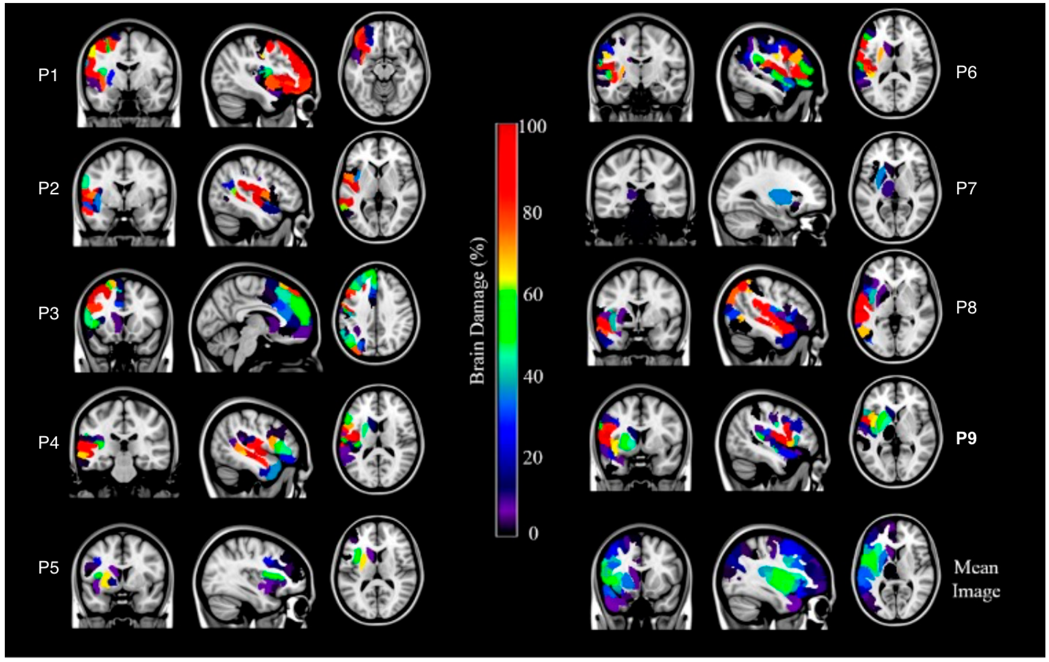 Neurosci 06 00122 g002