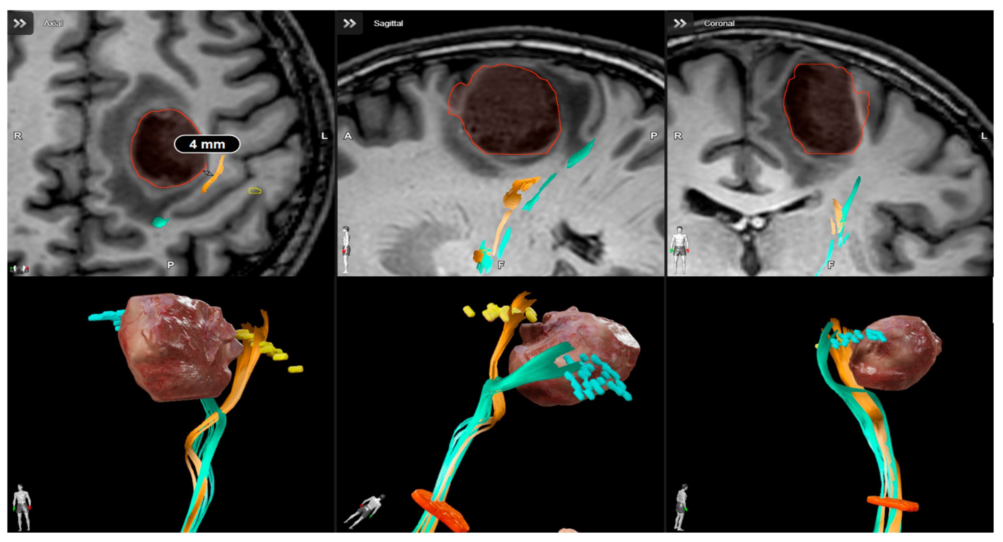 Neurosci 06 00124 g001 Neurosci 06 00124 g001