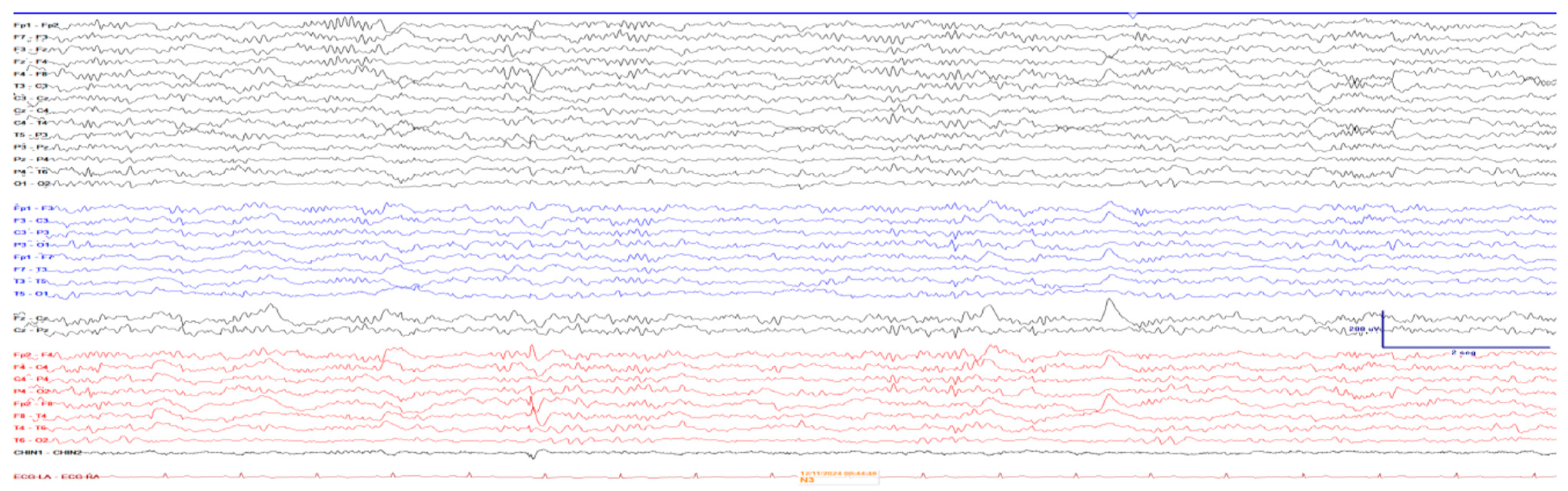 Neurosci 07 00004 g002 Neurosci 07 00004 g002