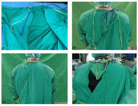 Nursing Reports | Free Full-Text | A Combined Tie-Fastening Method for the  Reusable Surgical Gown with Two Neck Tie Belts to Improve Wearing Comfort