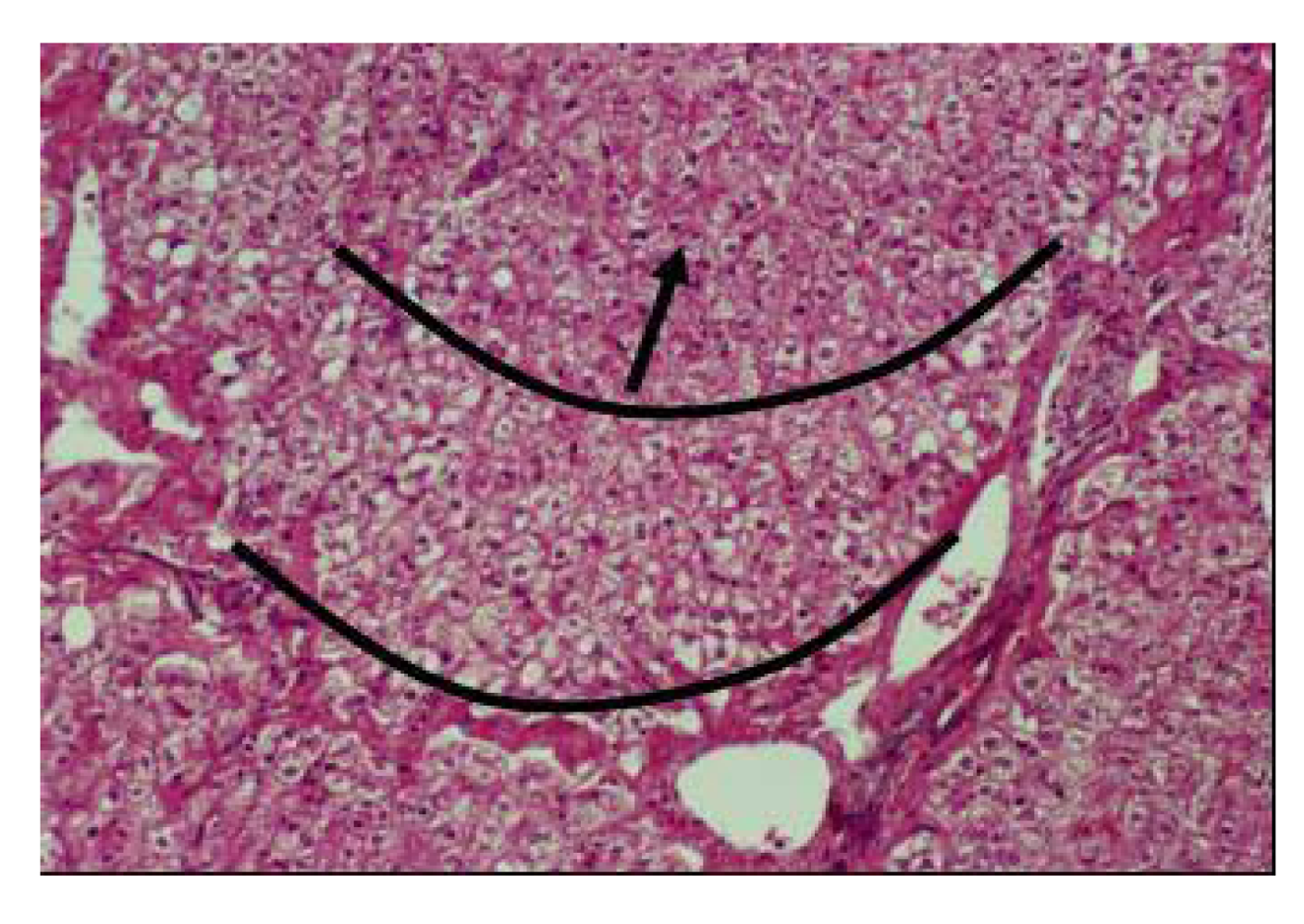 Nutrients 01 00030 g018 1024