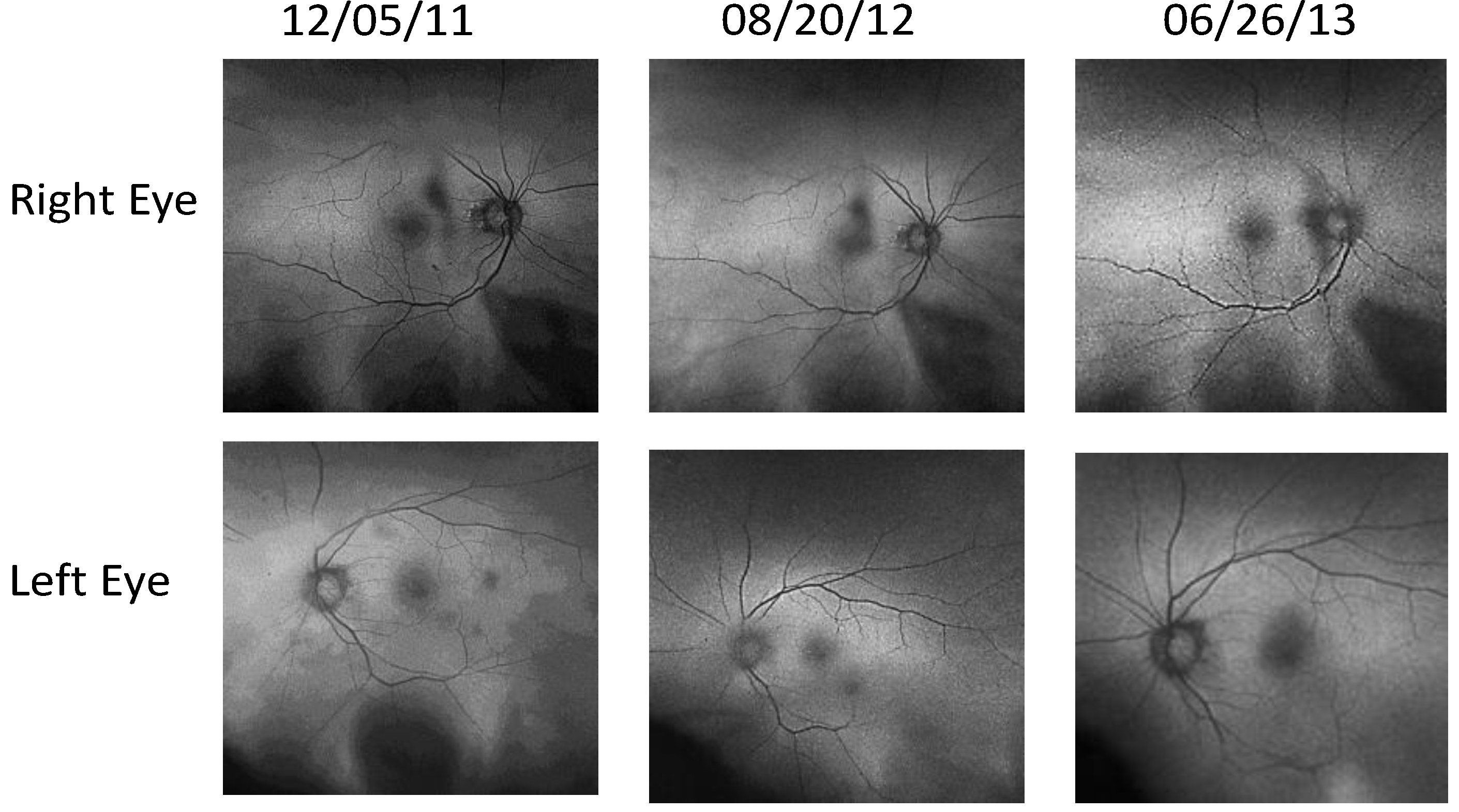 Nutrients 06 04404 g005 1024