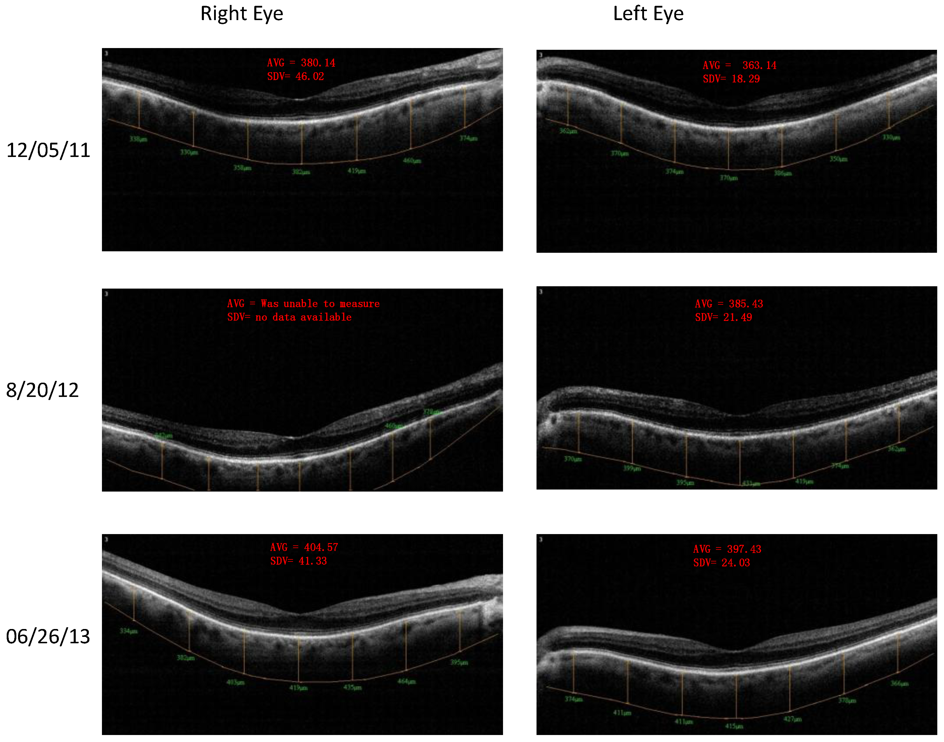 Nutrients 06 04404 g006 1024