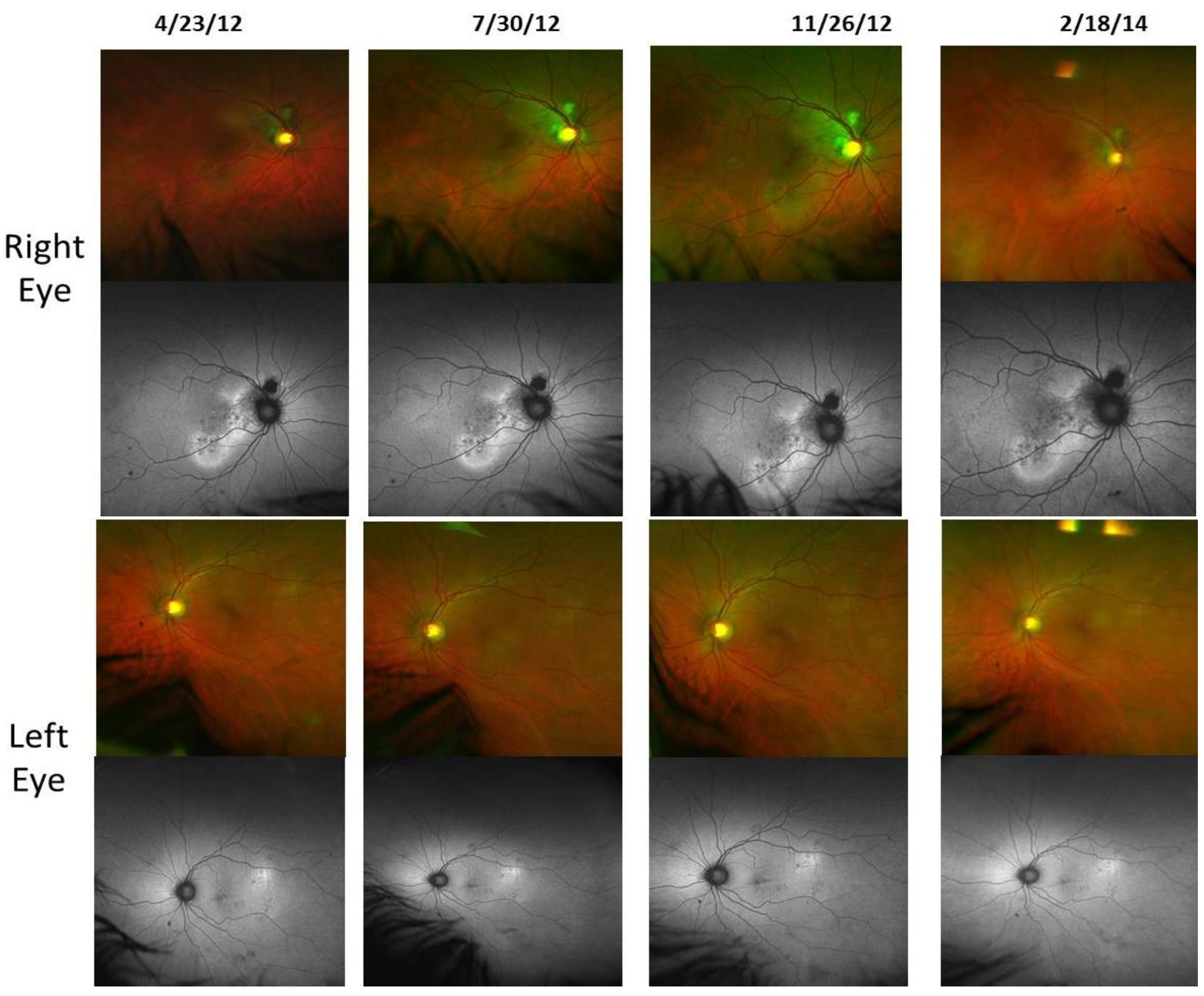 Nutrients 06 04404 g009 1024