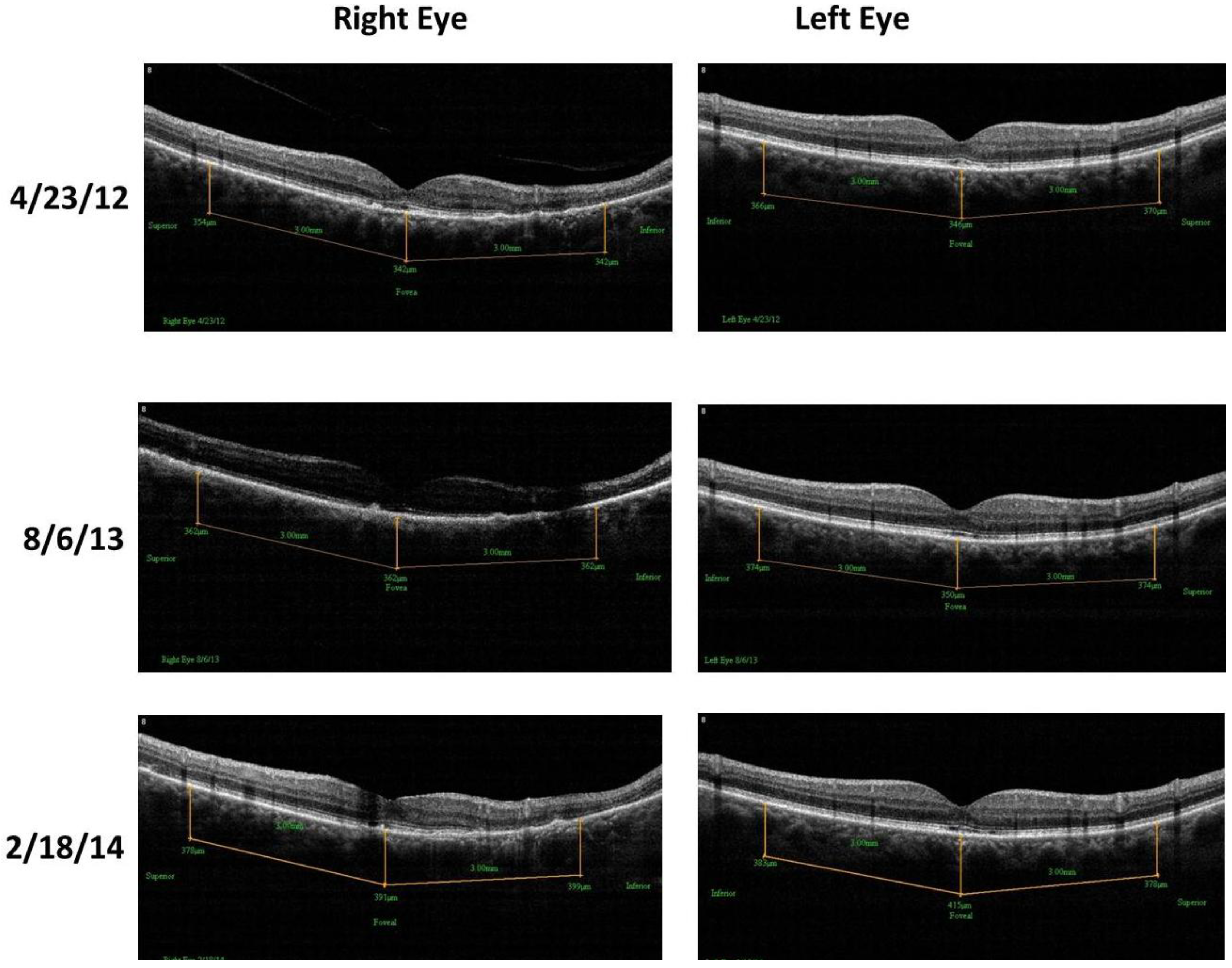 Nutrients 06 04404 g010 1024